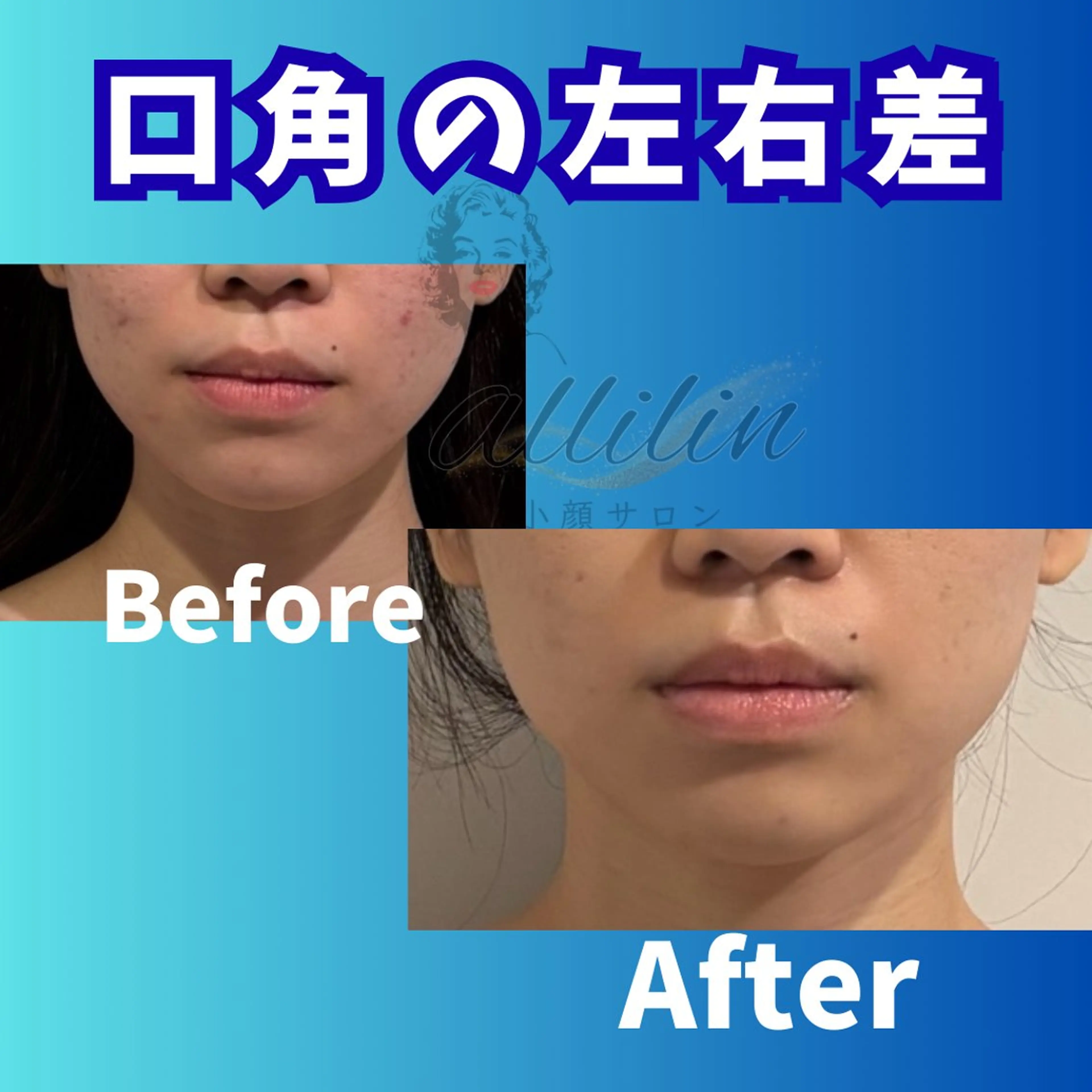 エステ 💎小顔サロン アリリン銀座💎のエステ・リラクイメージ