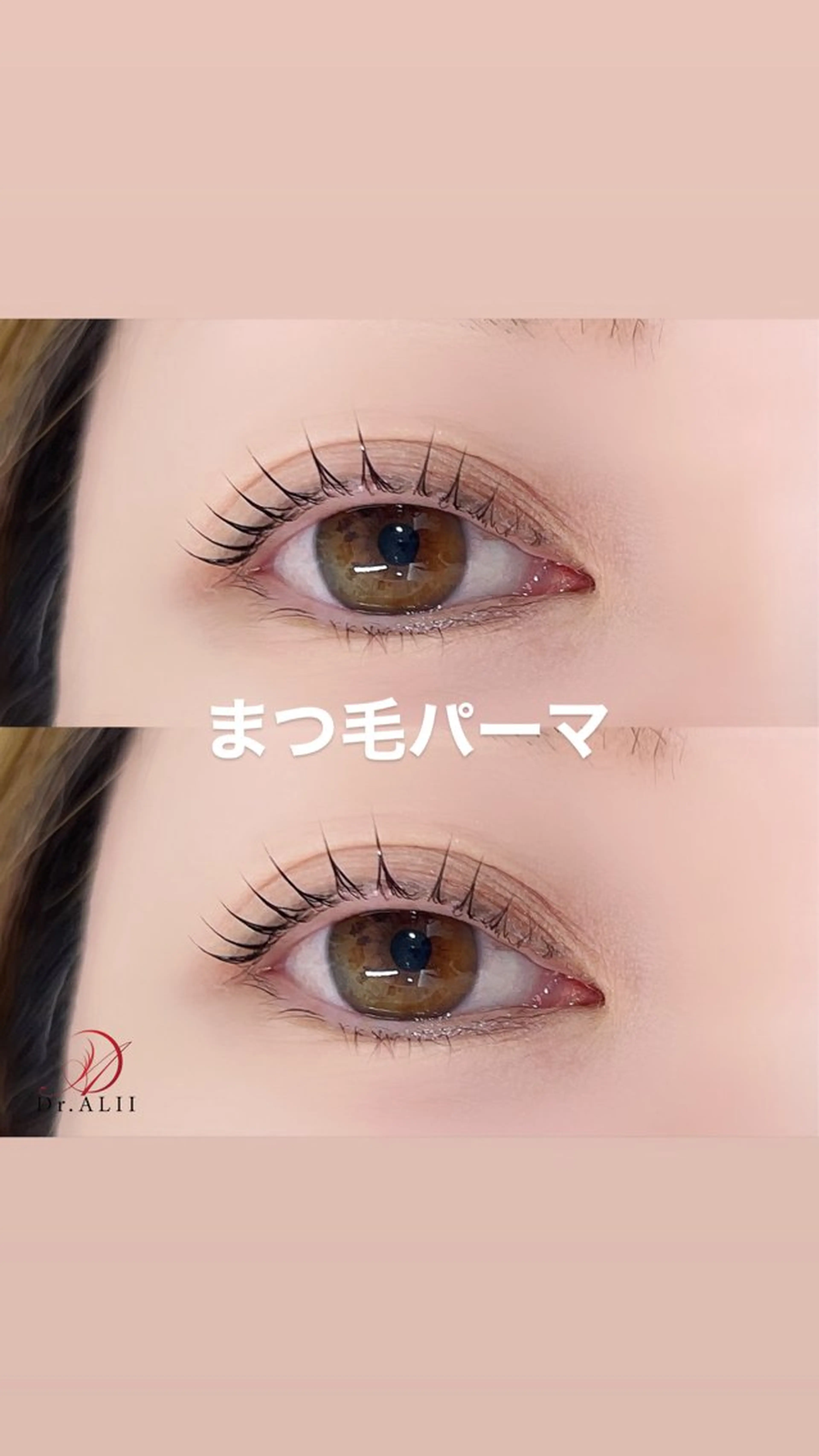 マツエク・マツパ 一重×まつ毛パーマ Dr.ALII岐南店所属・Dr.ALII 岐南店　鈴村のエステ・リラクイメージ