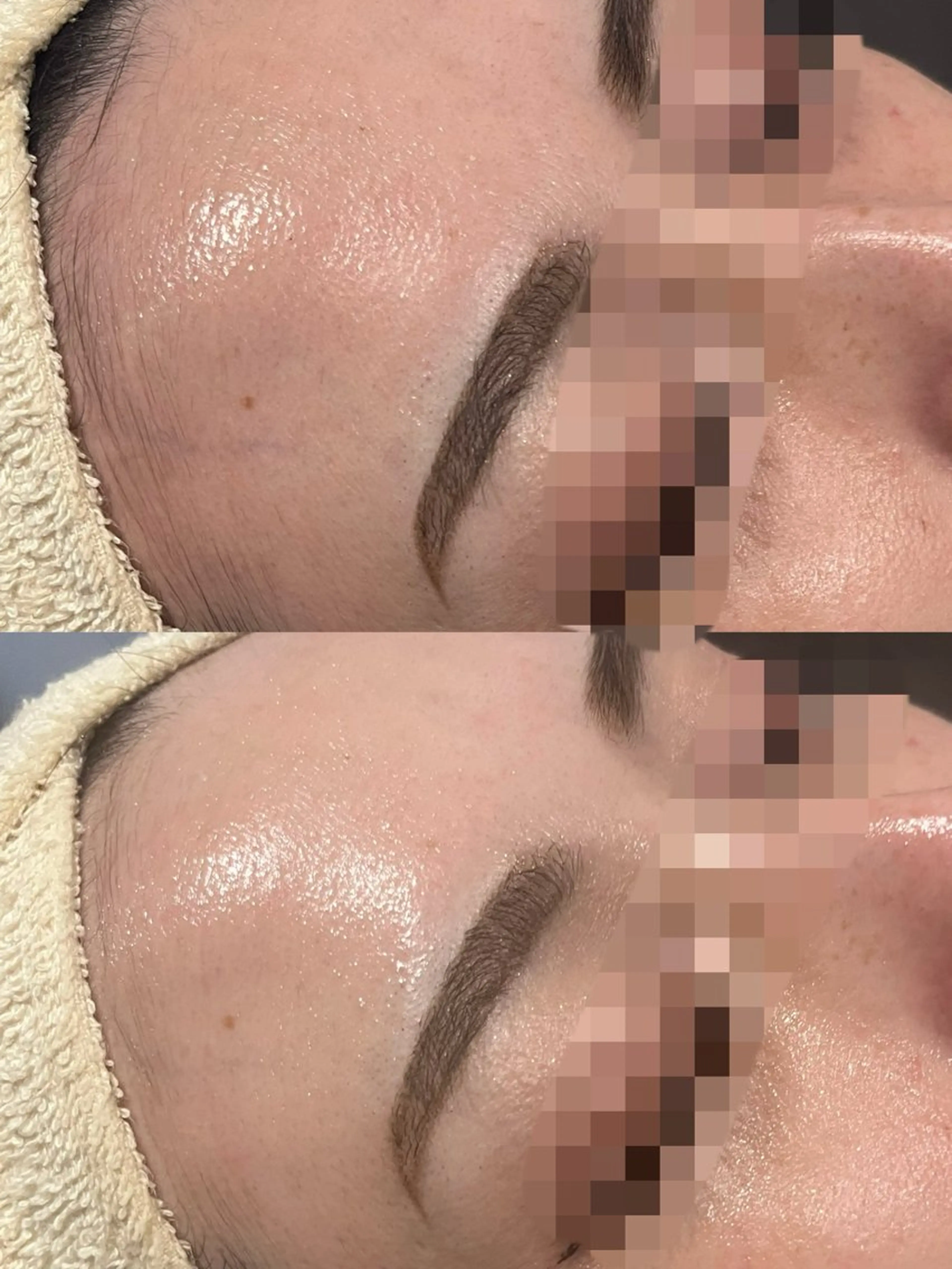 【韓国肌✕艶肌】フェイスワックス 💫韓国鎮静パック付き◎の写真