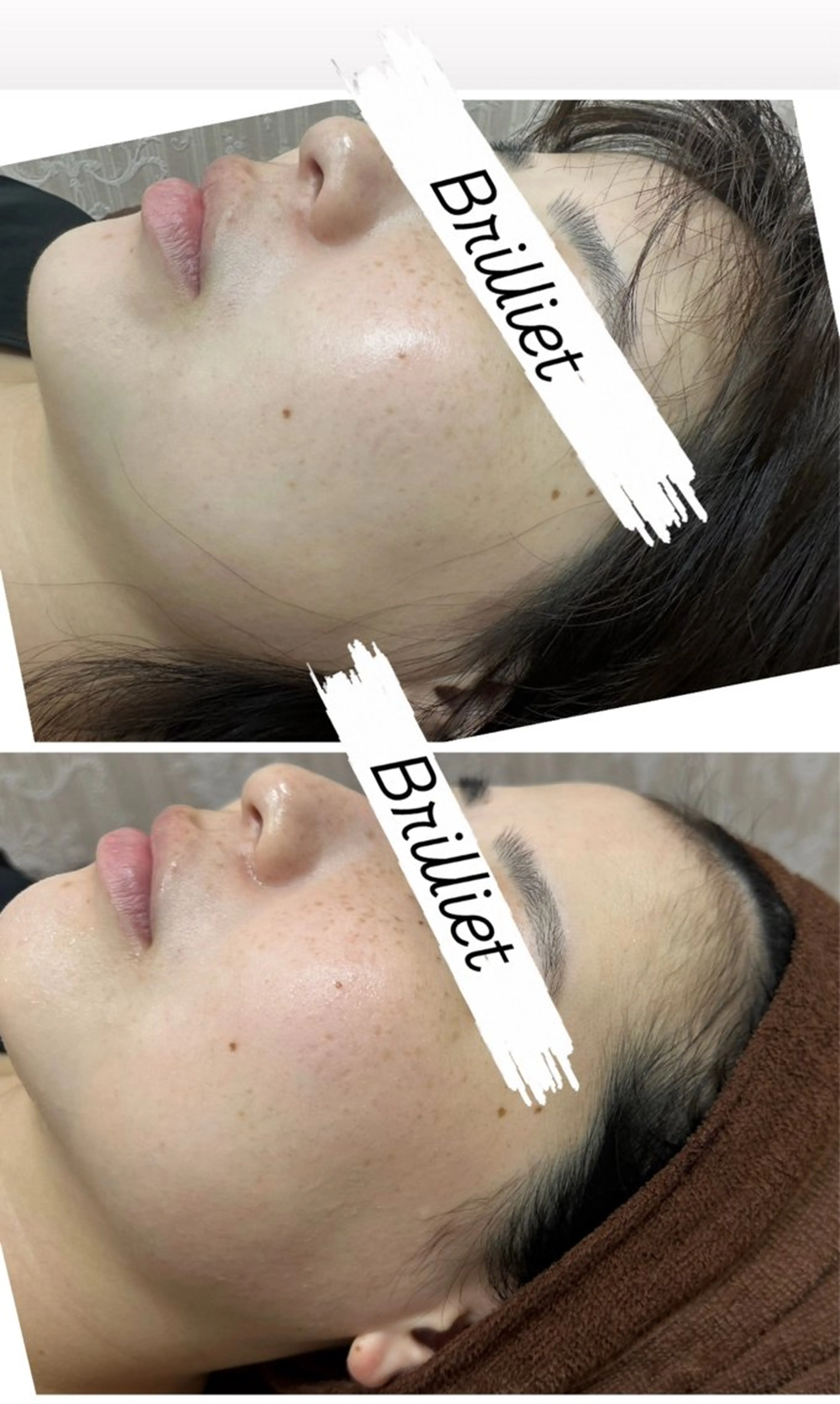 脱毛 桐山 まどかのその他イメージ