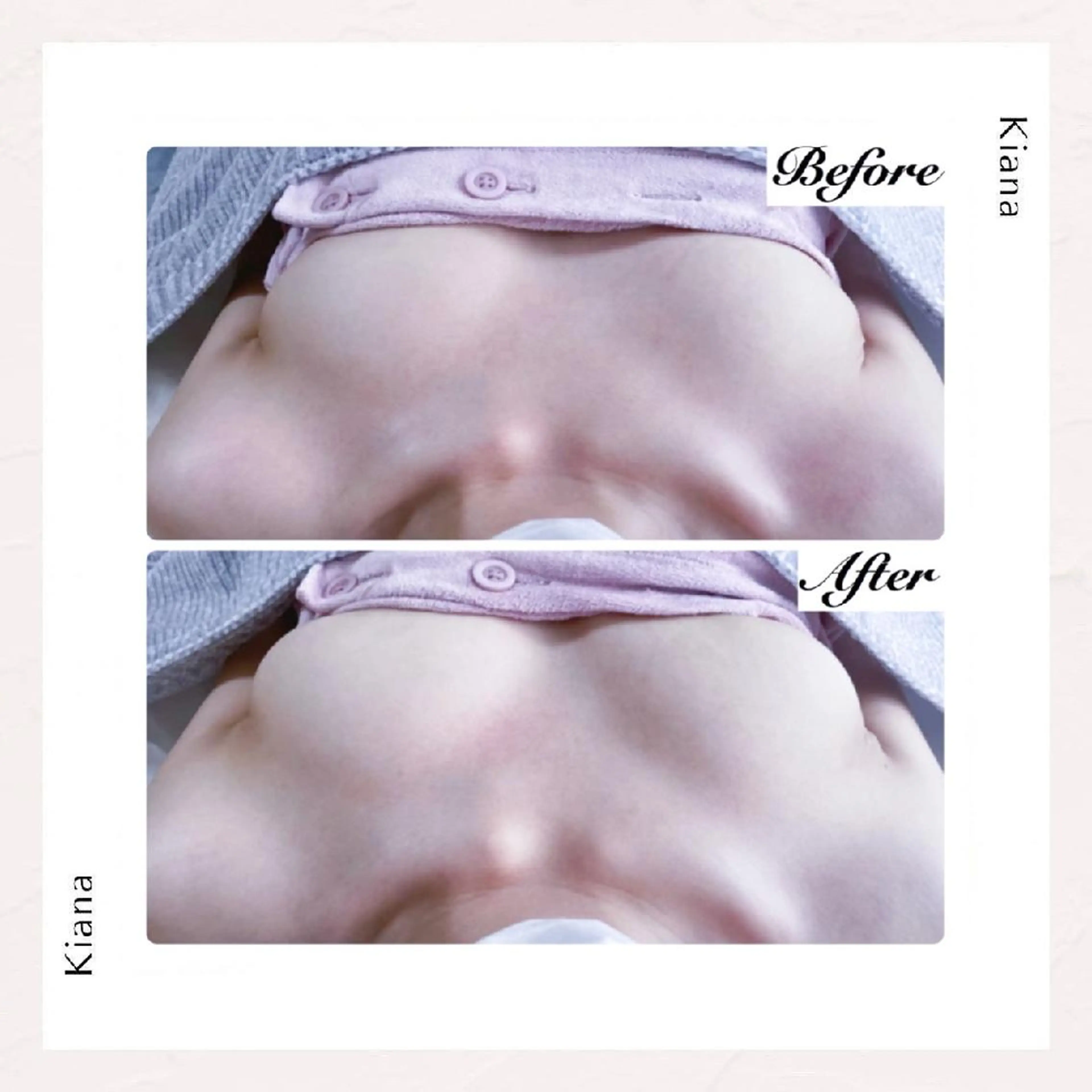 【バスト専門店 】 Kiana のエステ・リラクイメージ