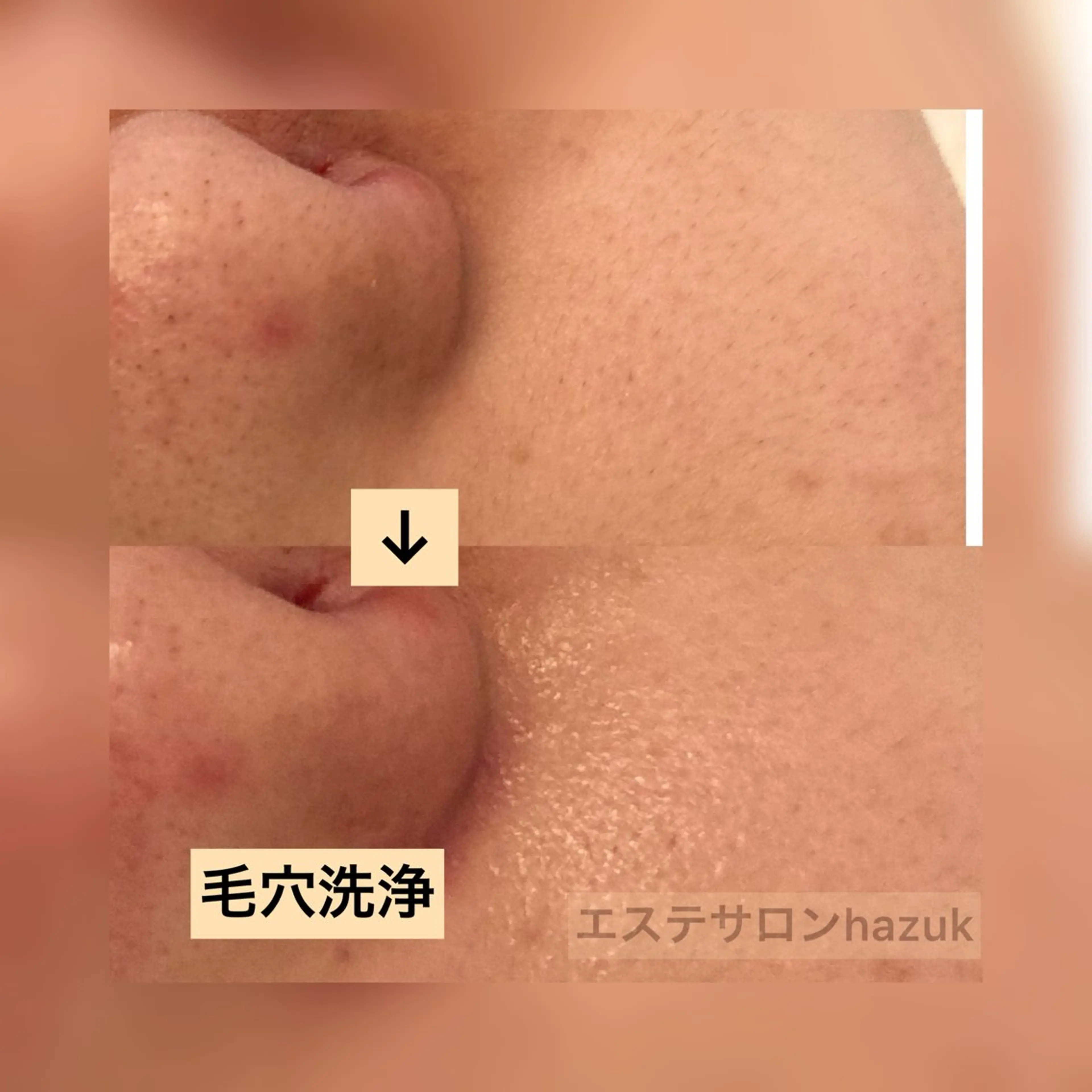 その他 たるみ改善小顔エステ 堀葉月のその他イメージ