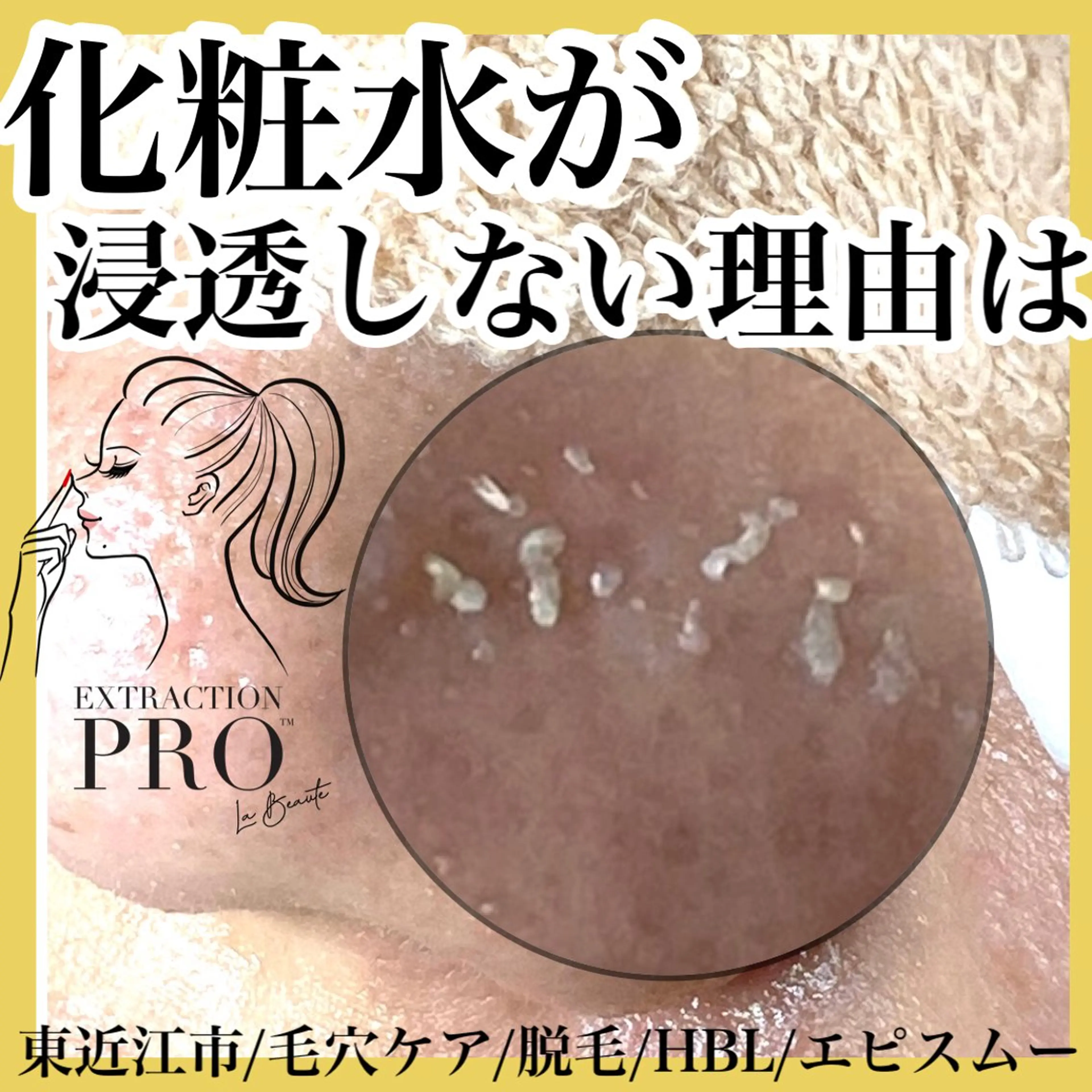 epismoo 脱毛/HBL/毛穴の眉毛・アイブロウイメージ