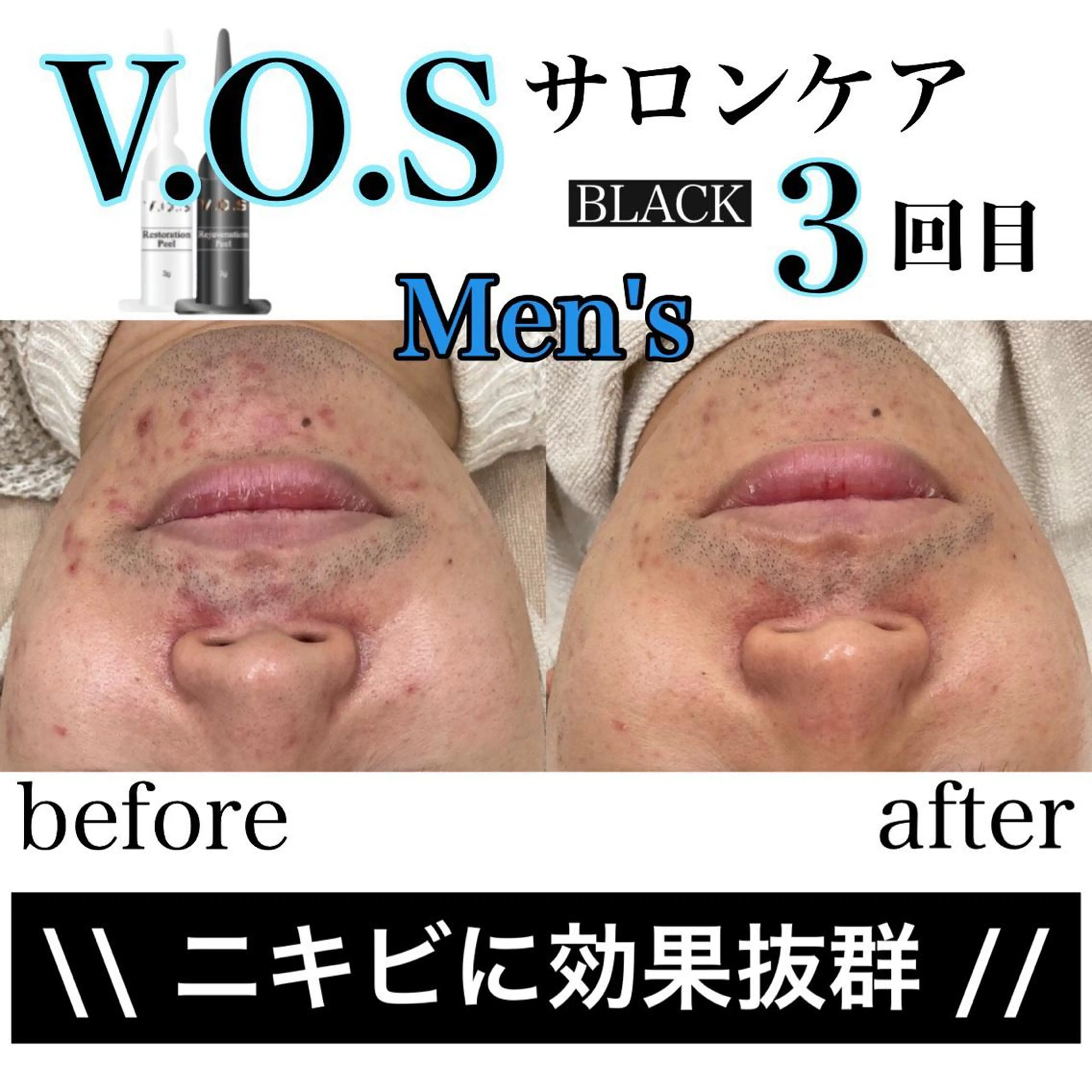 laluna saki...のその他イメージ