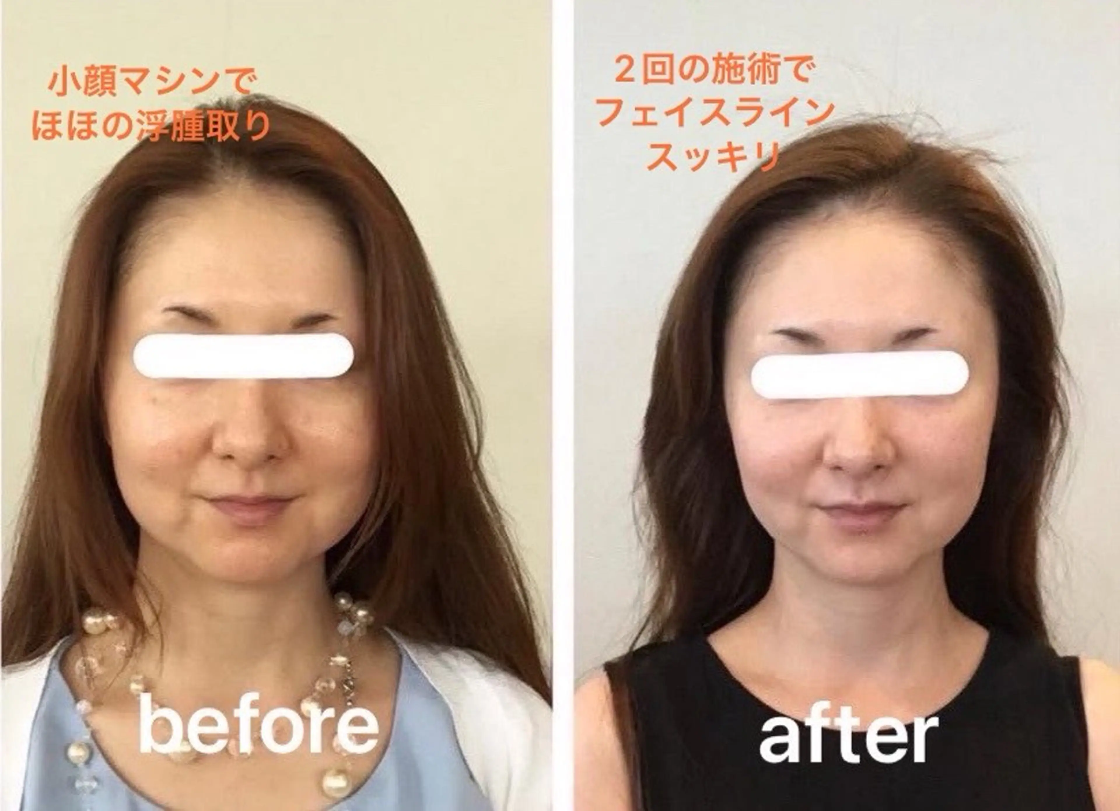 小顔専門店Embelli所属・小顔専門店 Embelliのその他イメージ