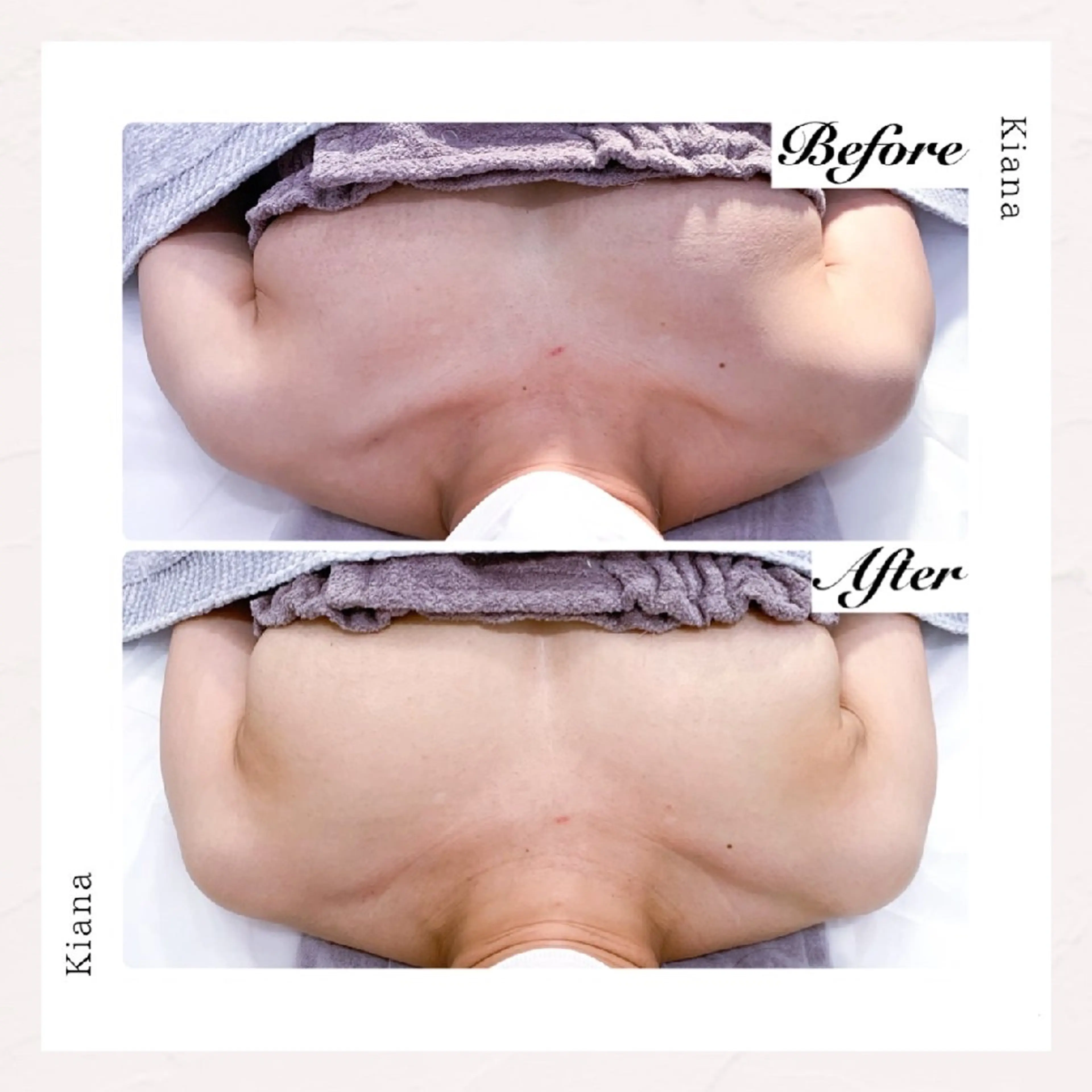 【バスト専門店 】 Kiana のエステ・リラクイメージ