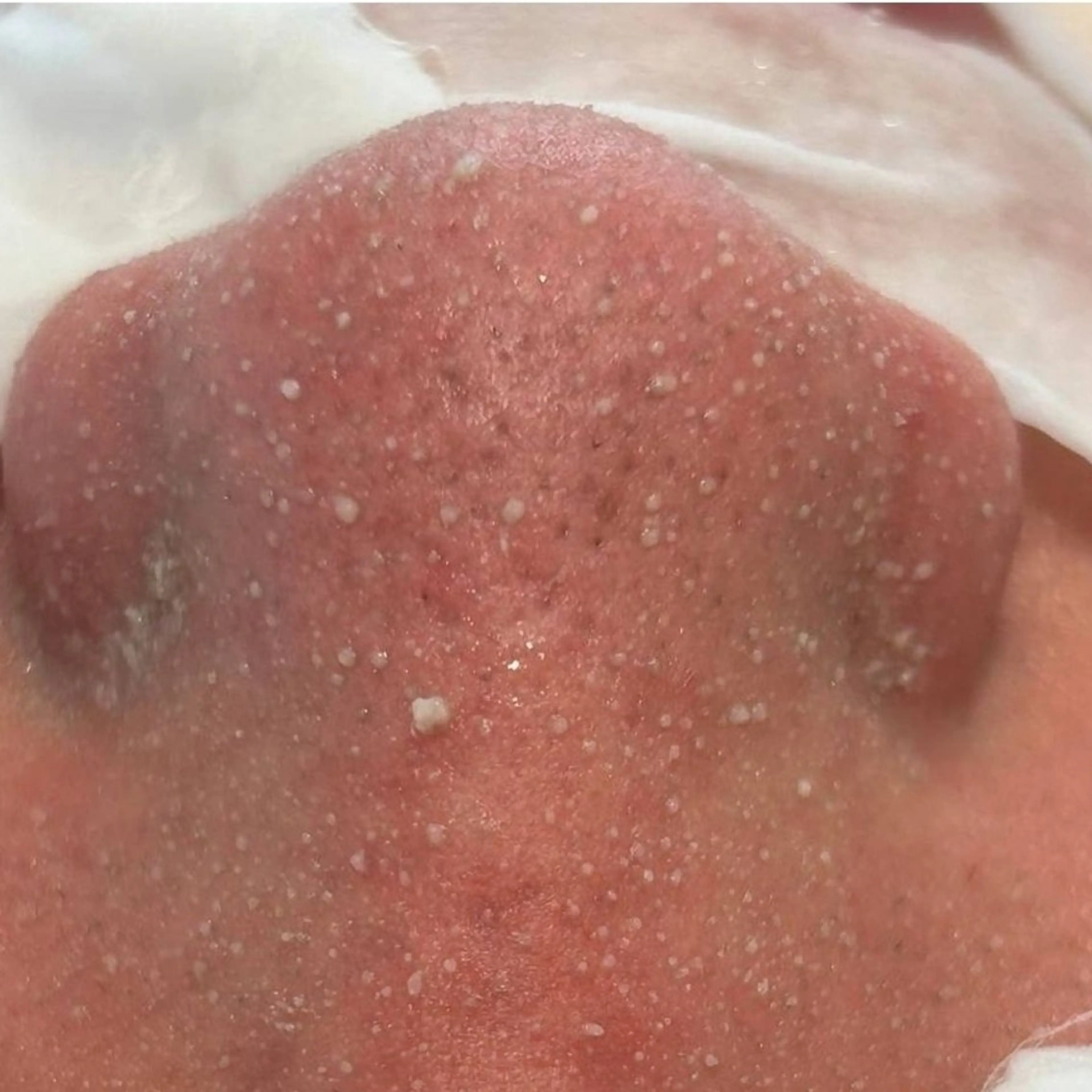 Hisui 種村のエステ・リラクイメージ