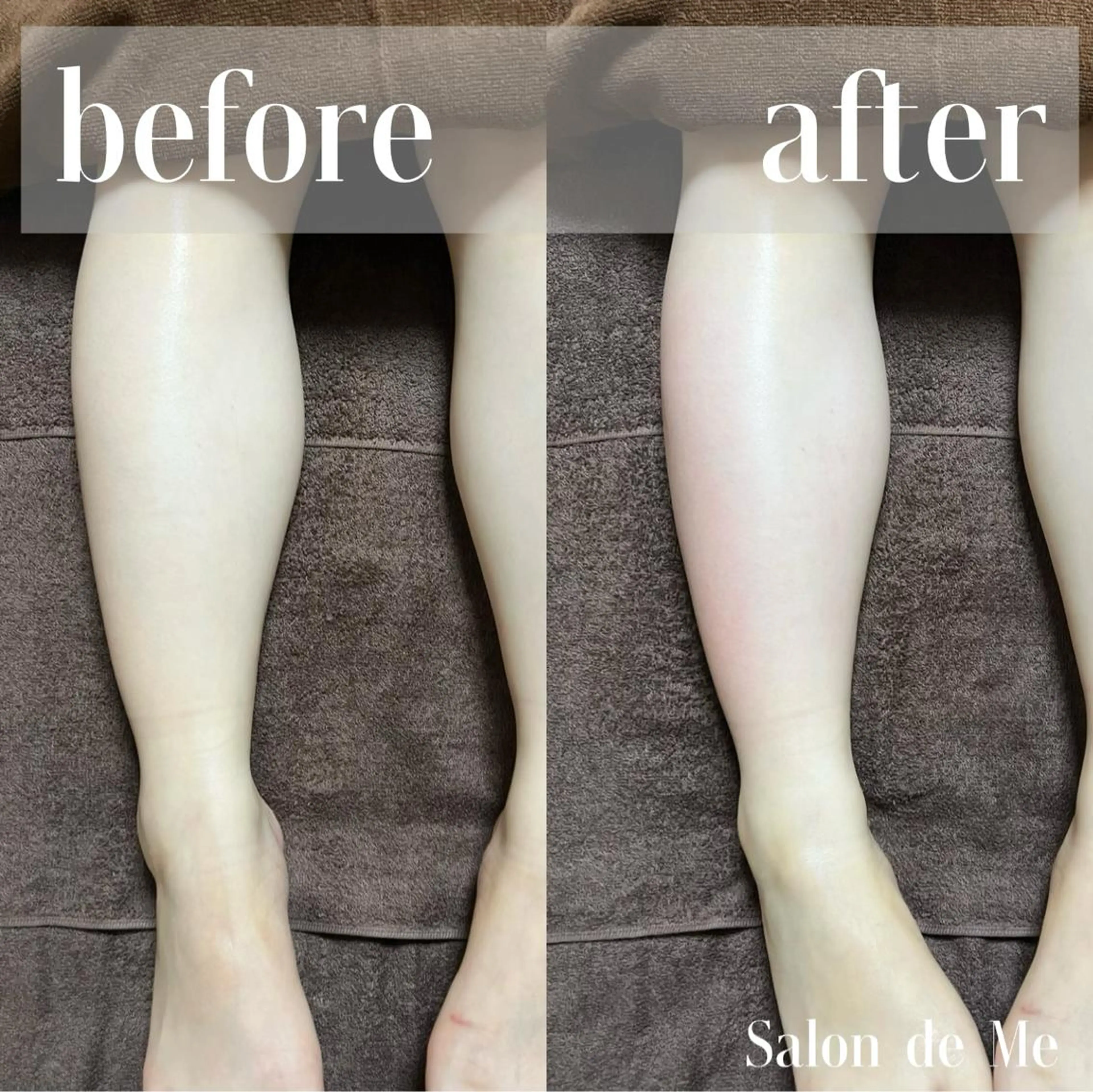 エステ Salon de Me所属・💫Salon de Me💫予約停止中のエステ・リラクイメージ