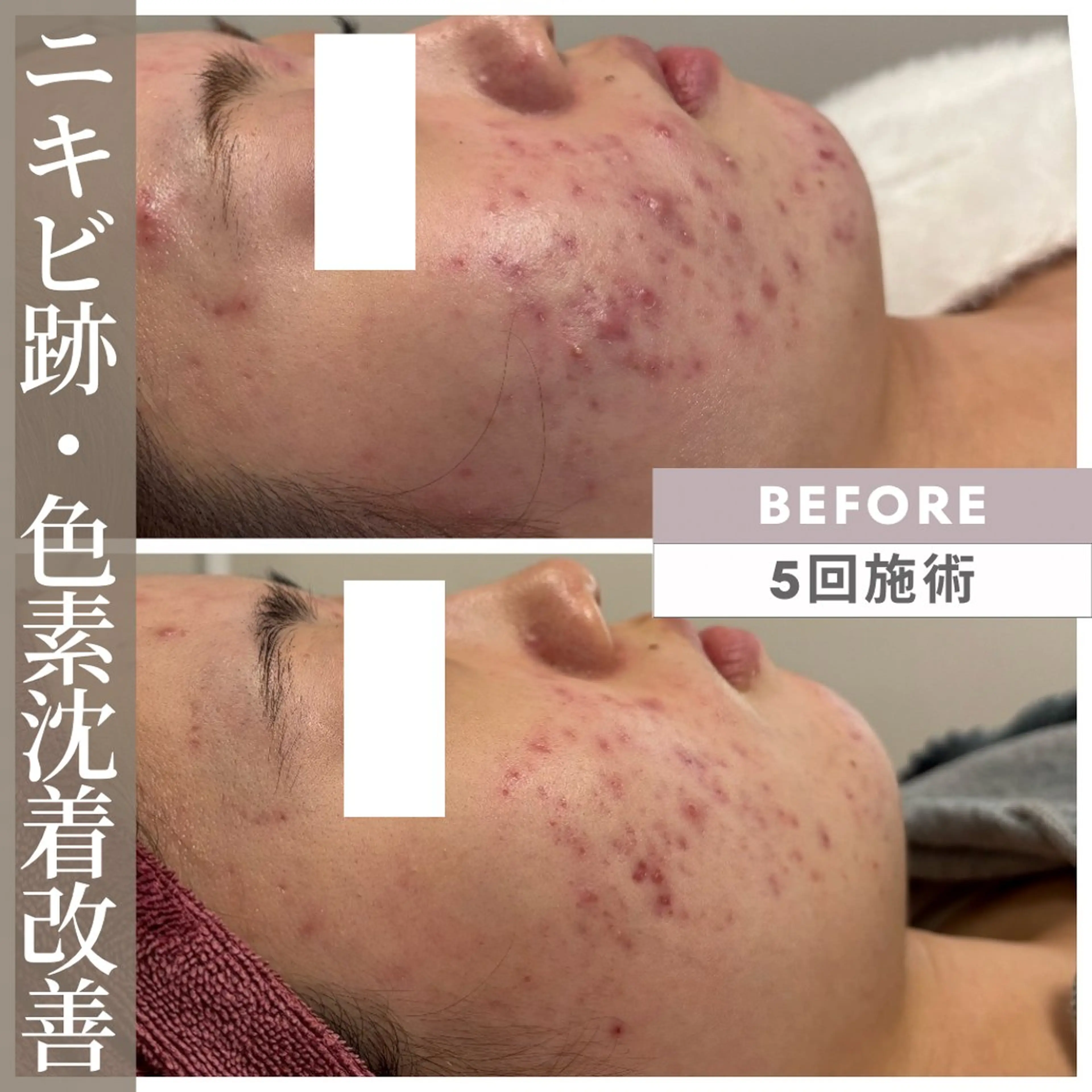 エステ 小顔矯正専門店 【RED】池田のエステ・リラクイメージ