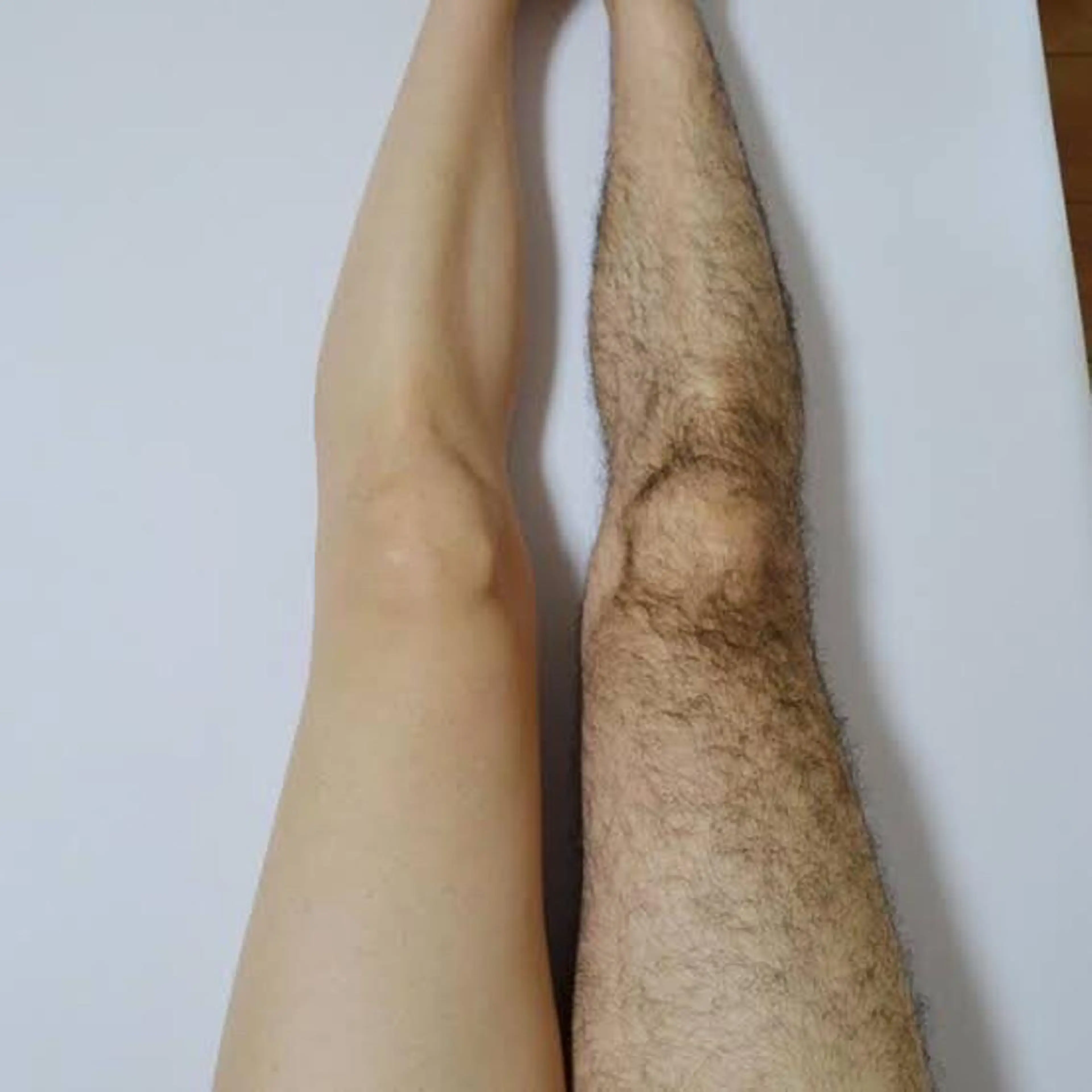 【毛穴までキレイに！】ひざ下脱毛￥7700の写真