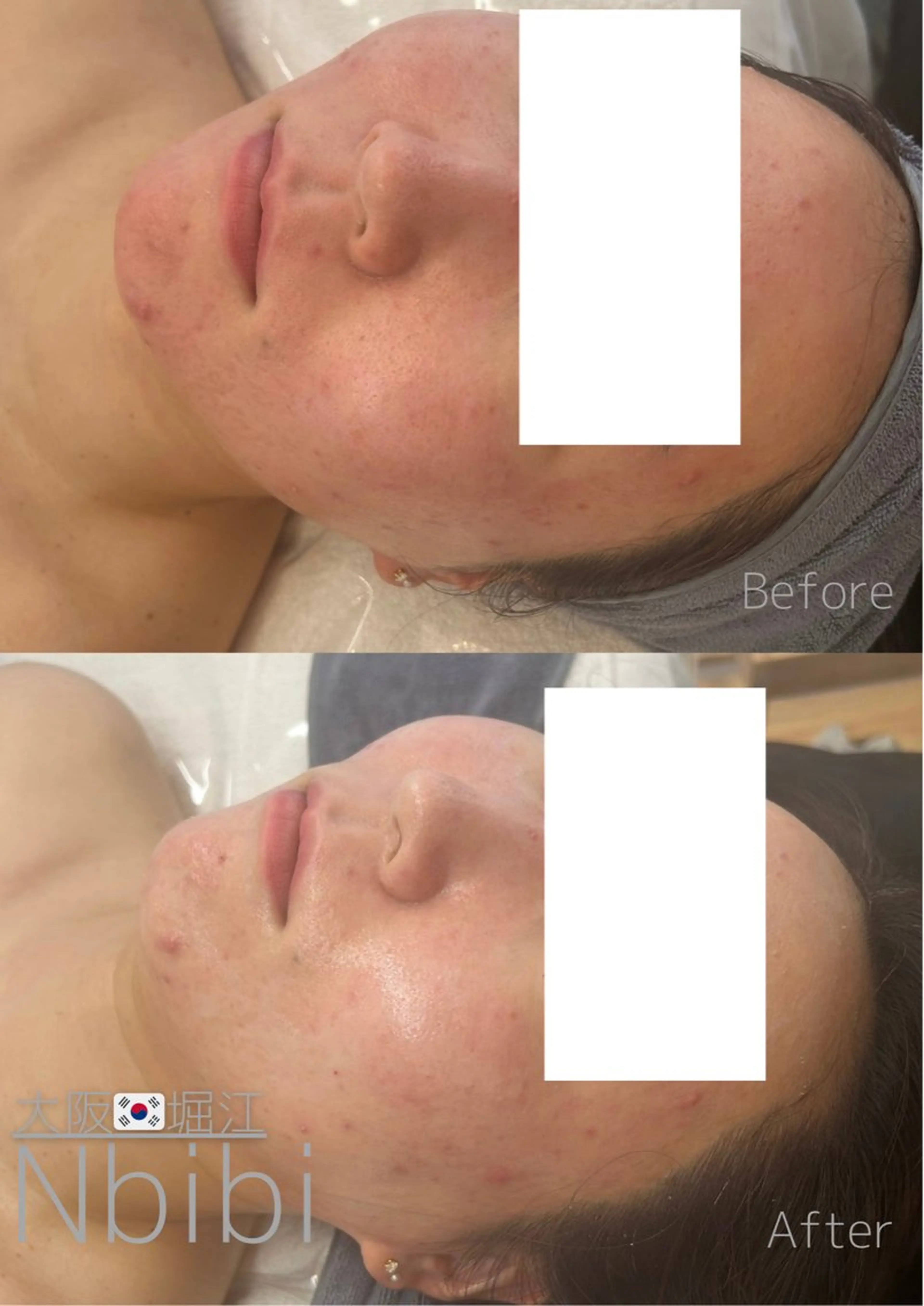 エステ 韓国🇰🇷価格 サロン_Nbibiのエステ・リラクイメージ