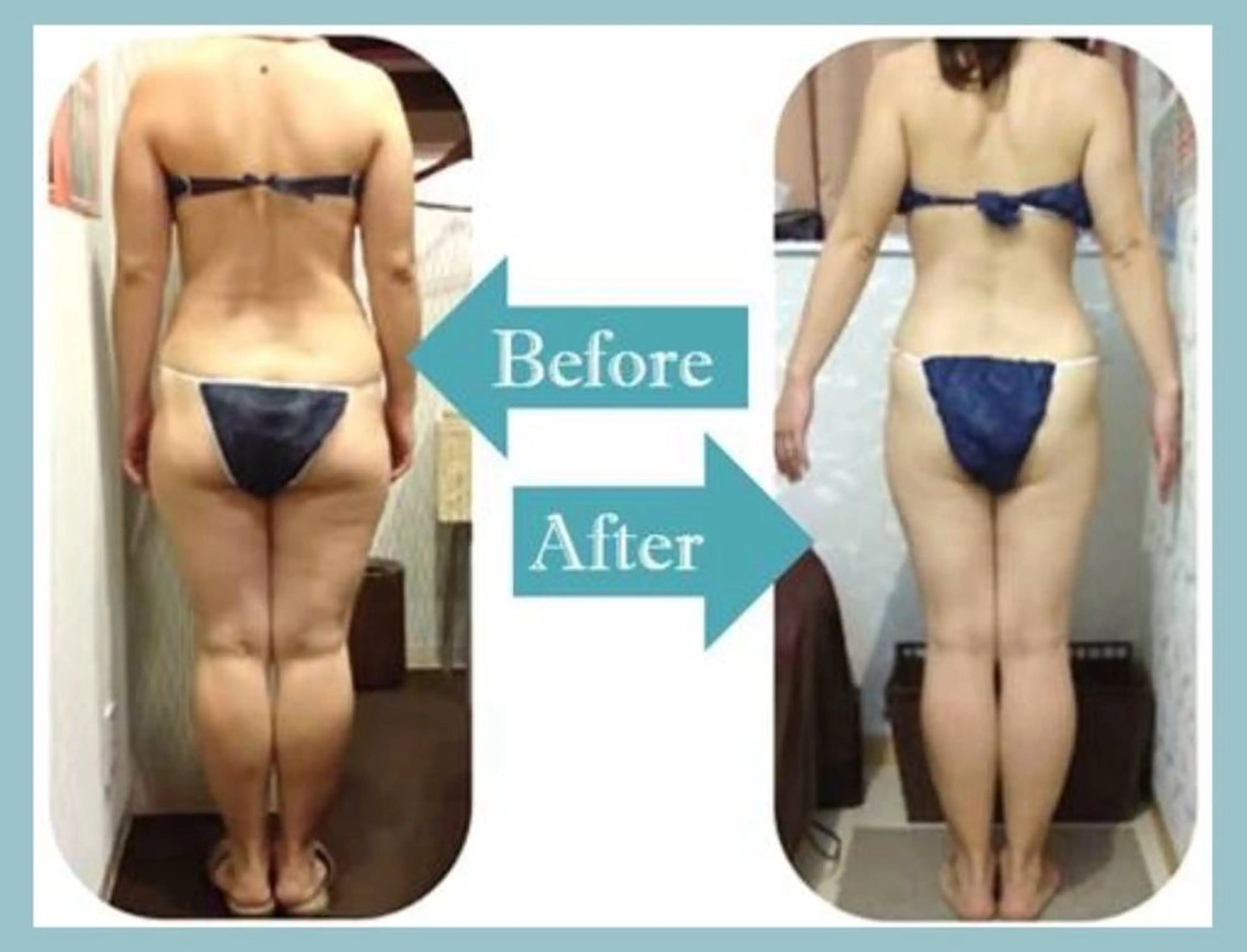 痩身・小顔・美肌専門 Chou chouのエステ・リラクイメージ