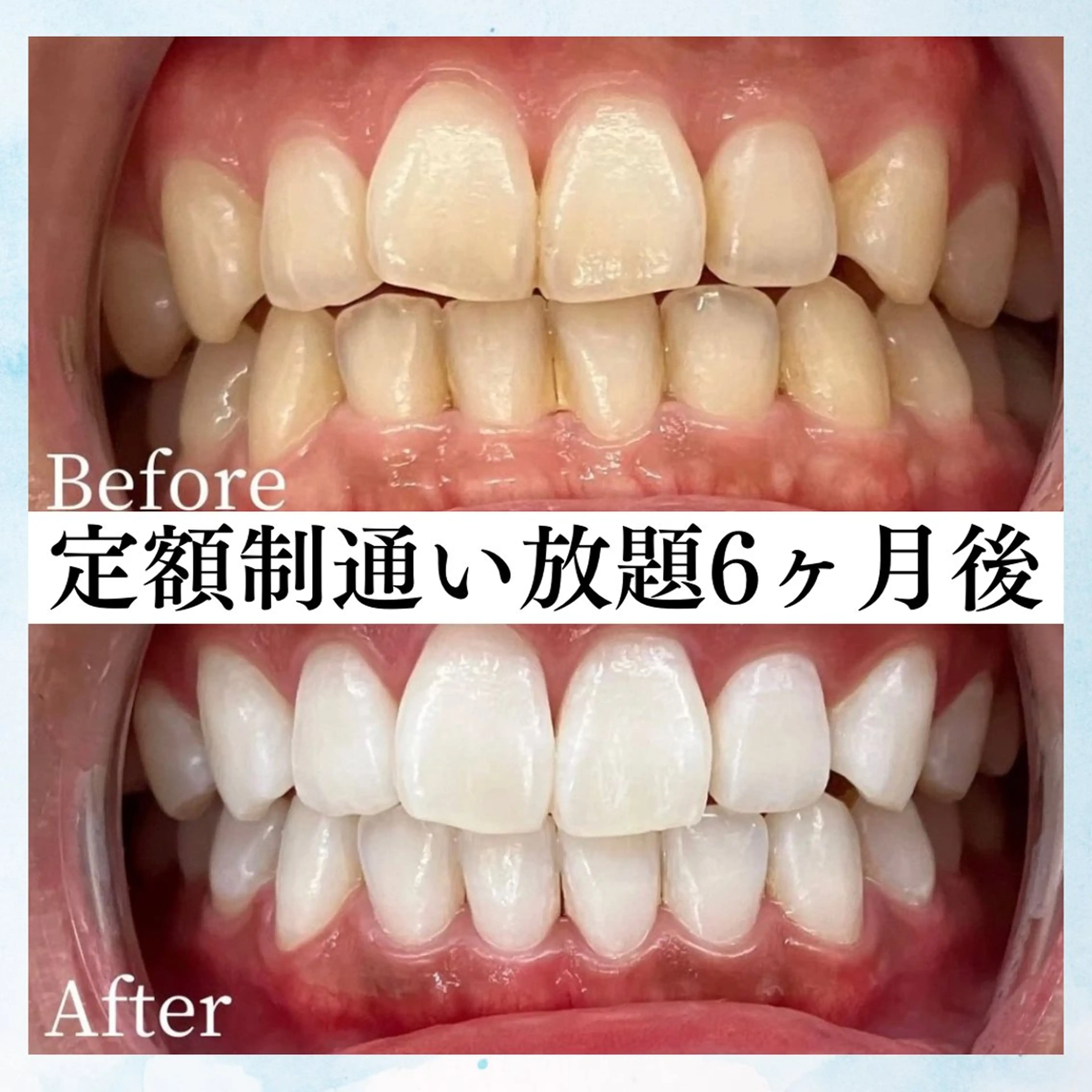 メンズ ホワイトニング専門店 WHITE天神店のエステ・リラクイメージ