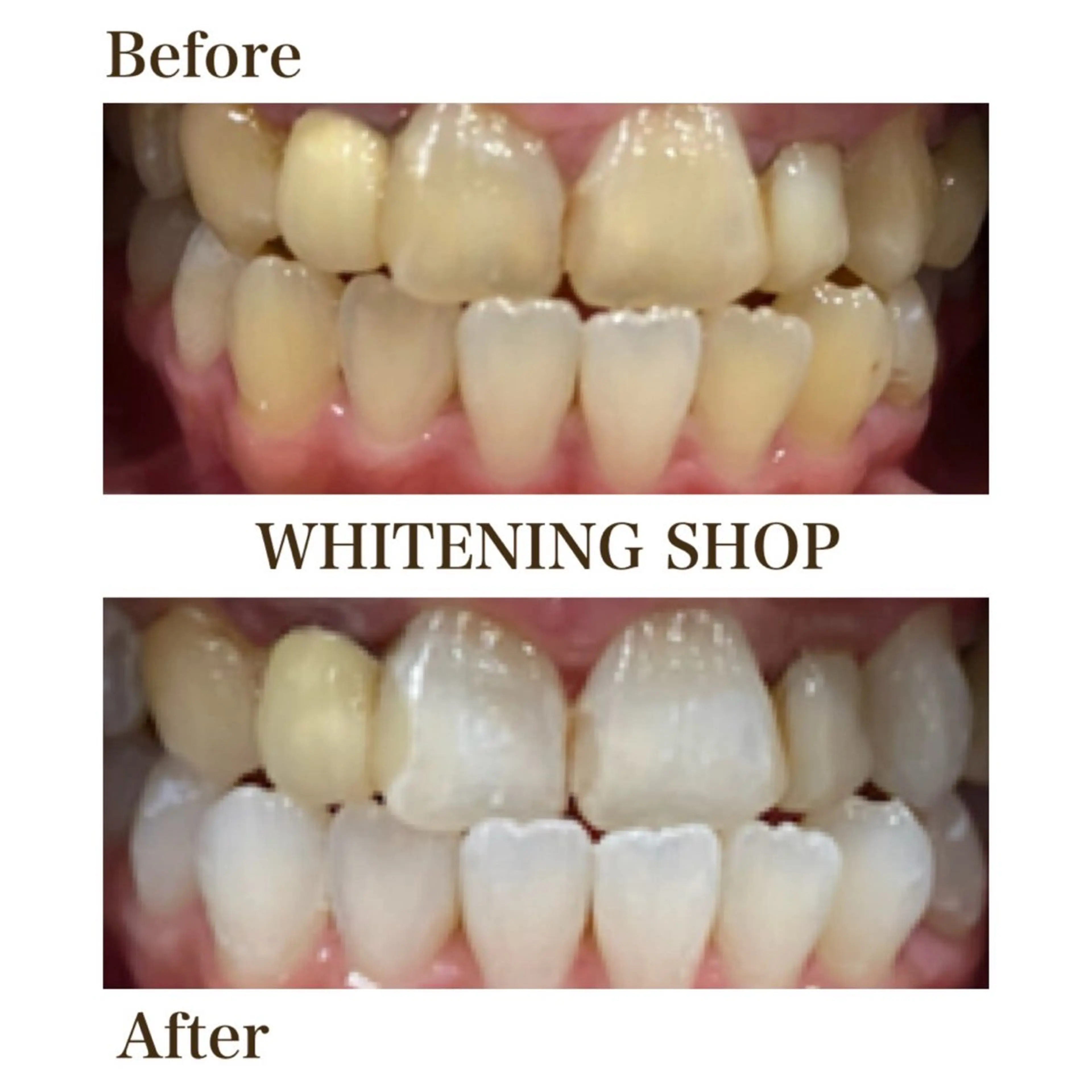 ホワイトニング ショップ川越店のエステ・リラクイメージ