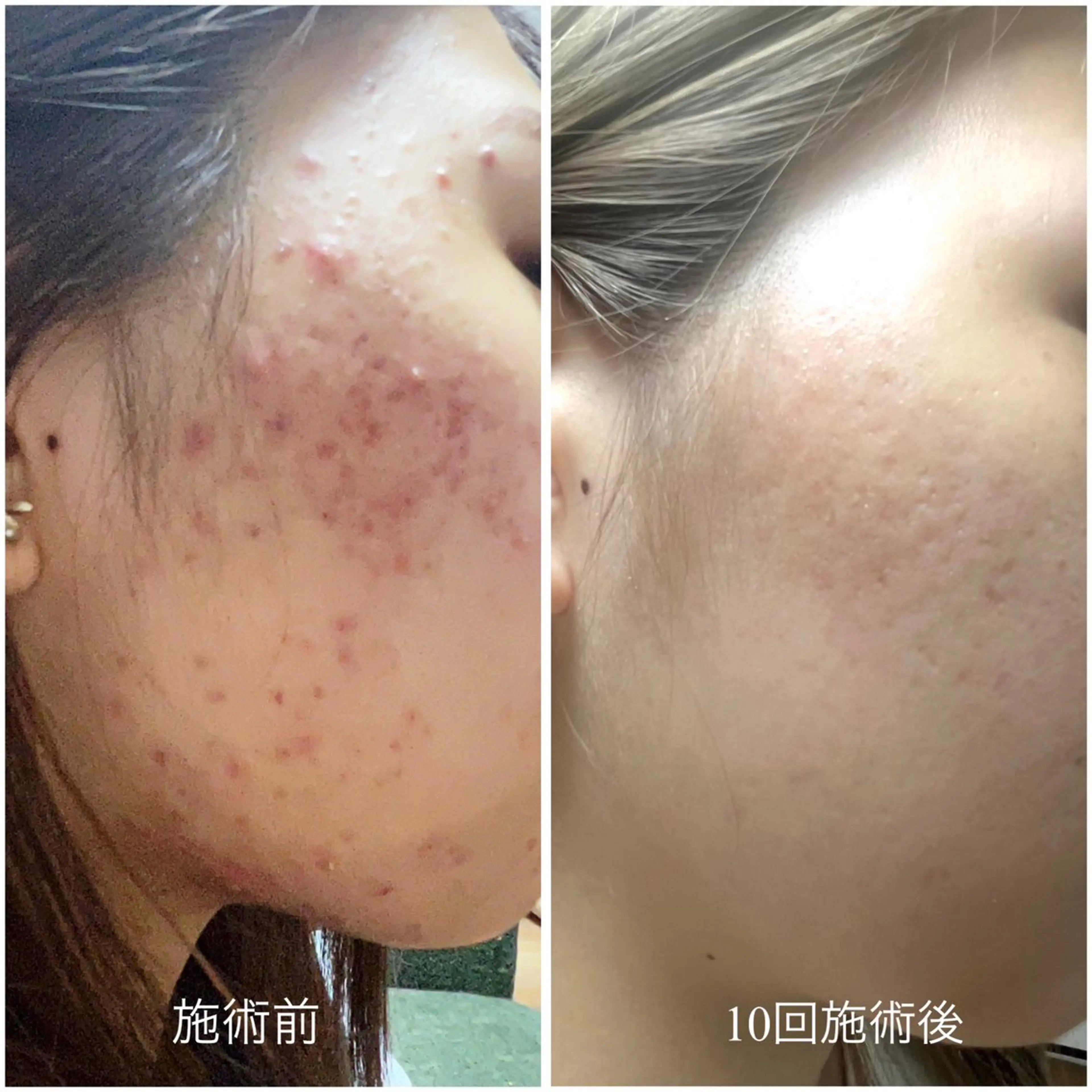 エステ スリーエスプラス内　美肌サロンEme所属・希映 -kieのエステ・リラクイメージ