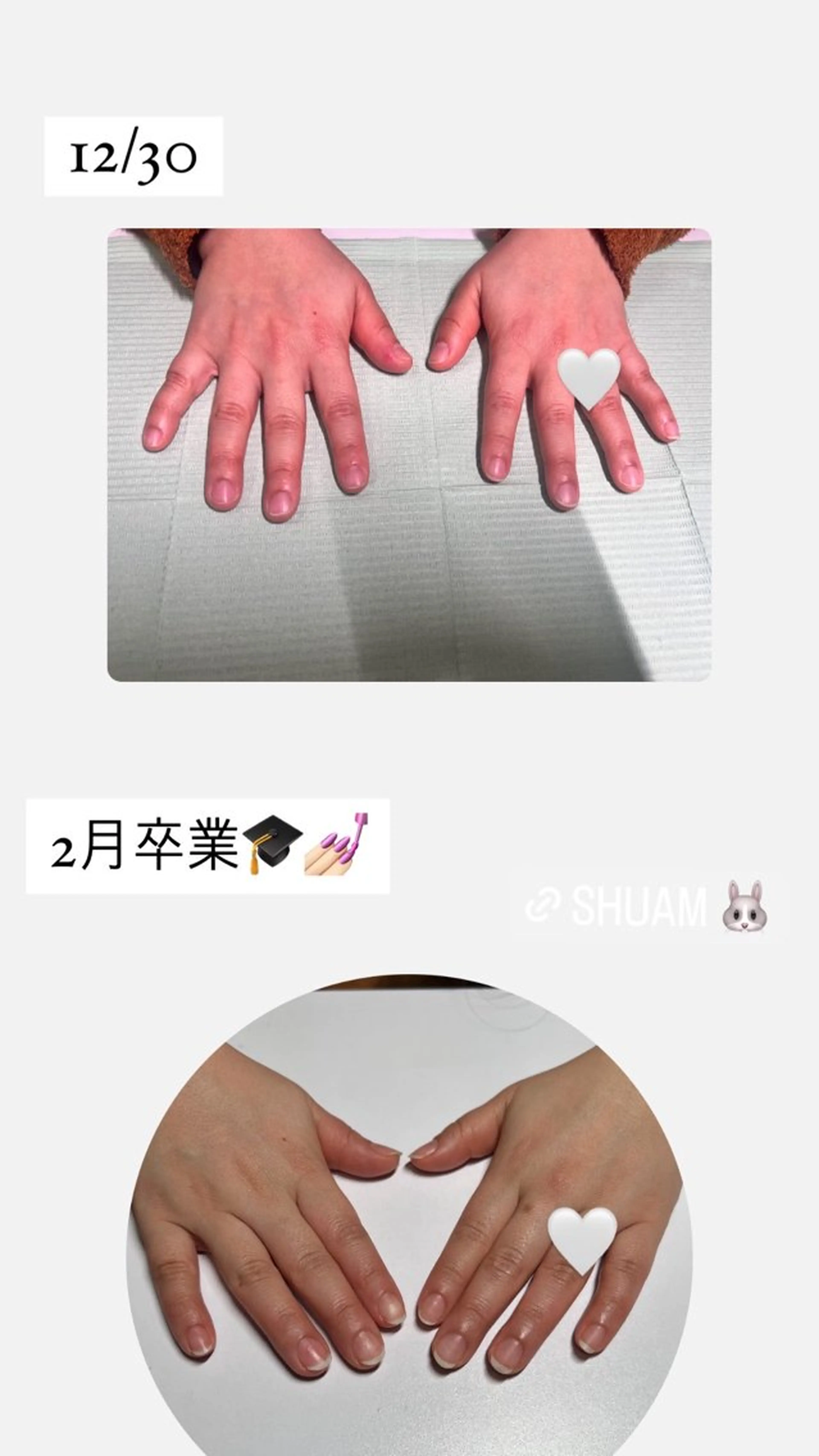 メンズ ネイル 爪ケア/深爪 自爪育成 🐰えむのネイルデザイン