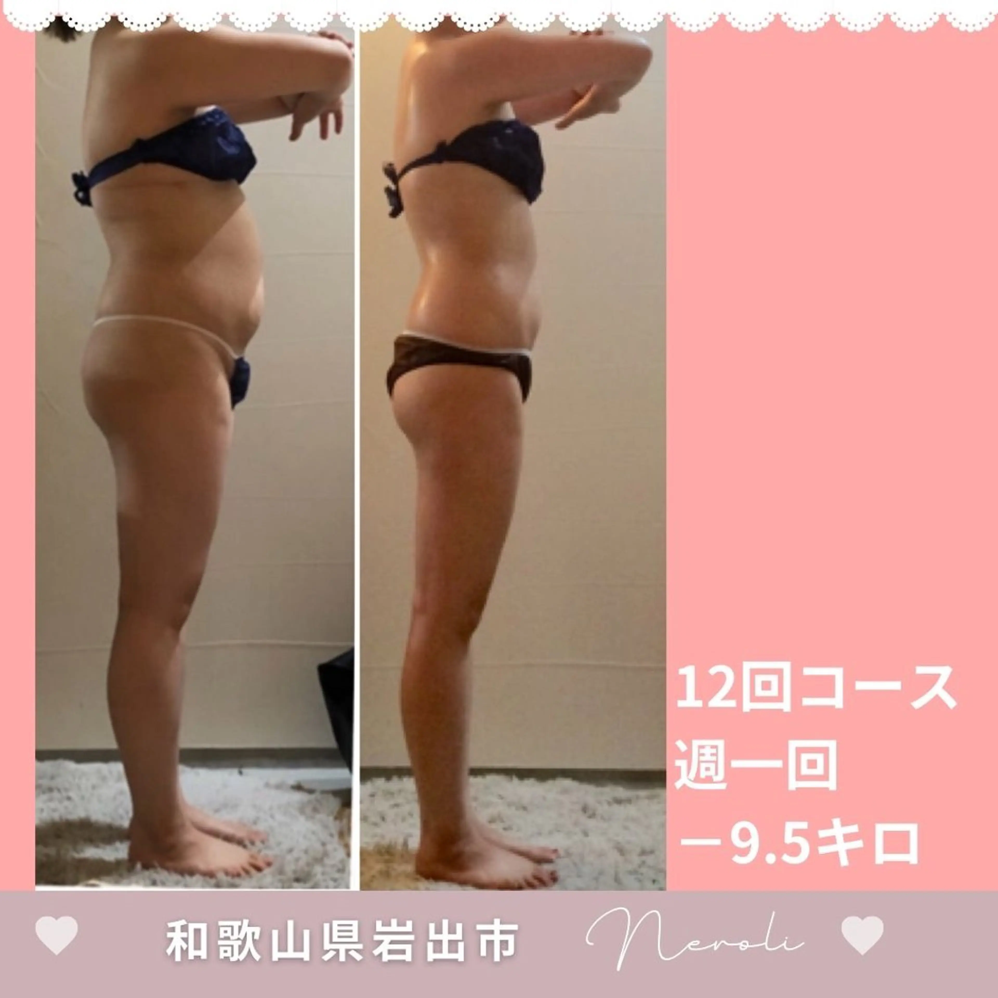 温活beautyサロンNeroli所属・切らない脂肪吸引🔥 Neroliまりこのエステ・リラクイメージ