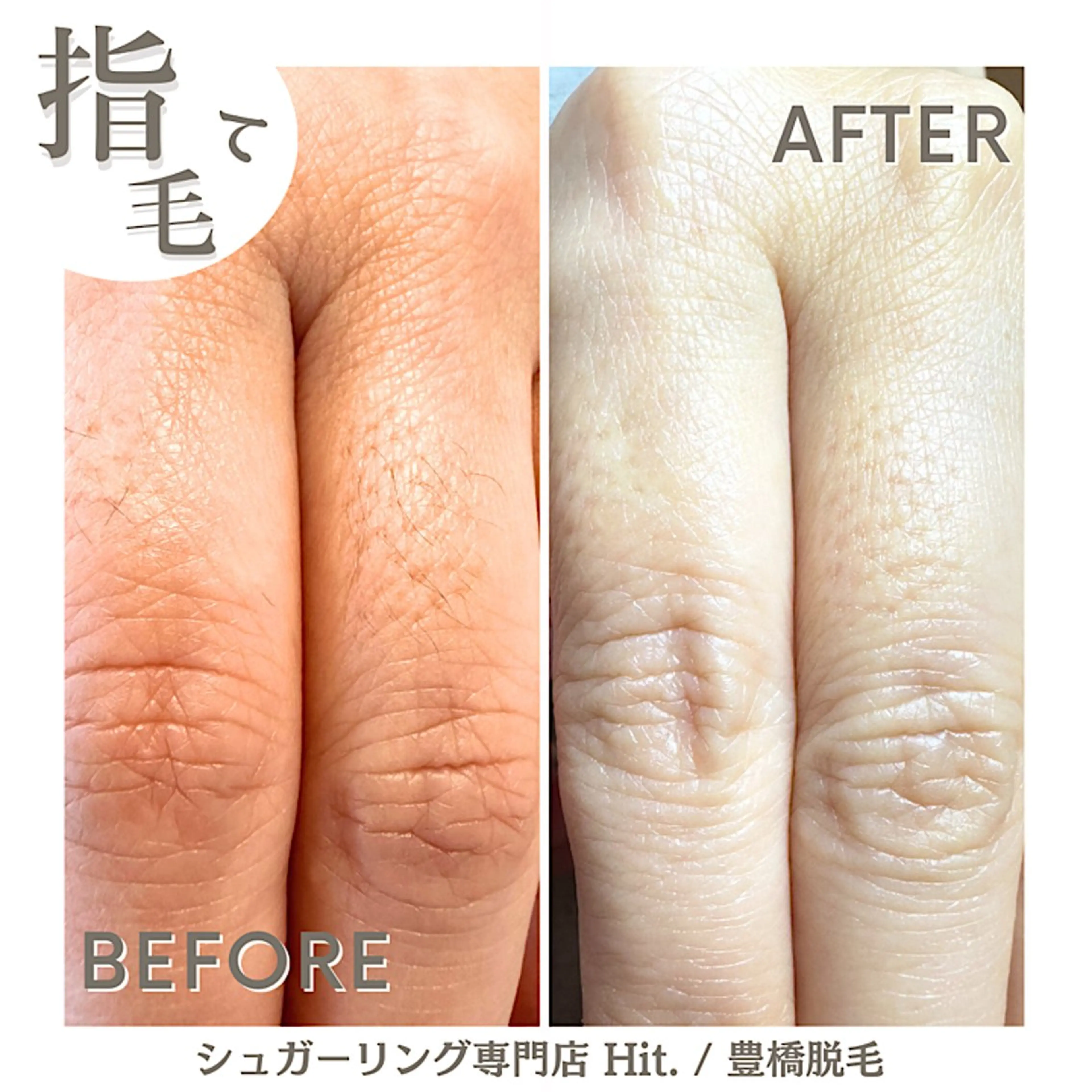 Hit. シュガーリング豊橋のエステ・リラクイメージ