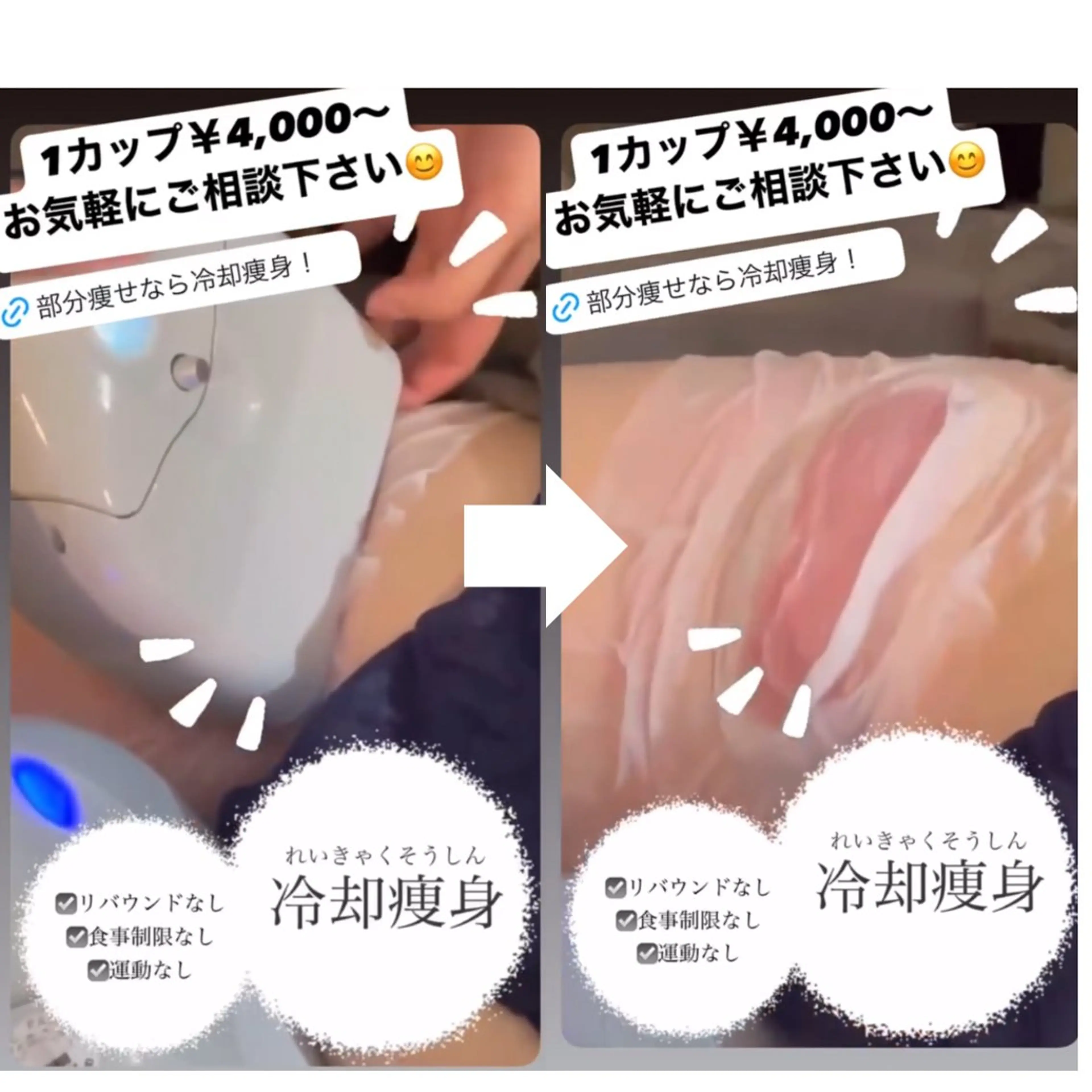 目標とする体型をお助け👯‍♀️《冷却痩身》1カップ￥4,000～の写真