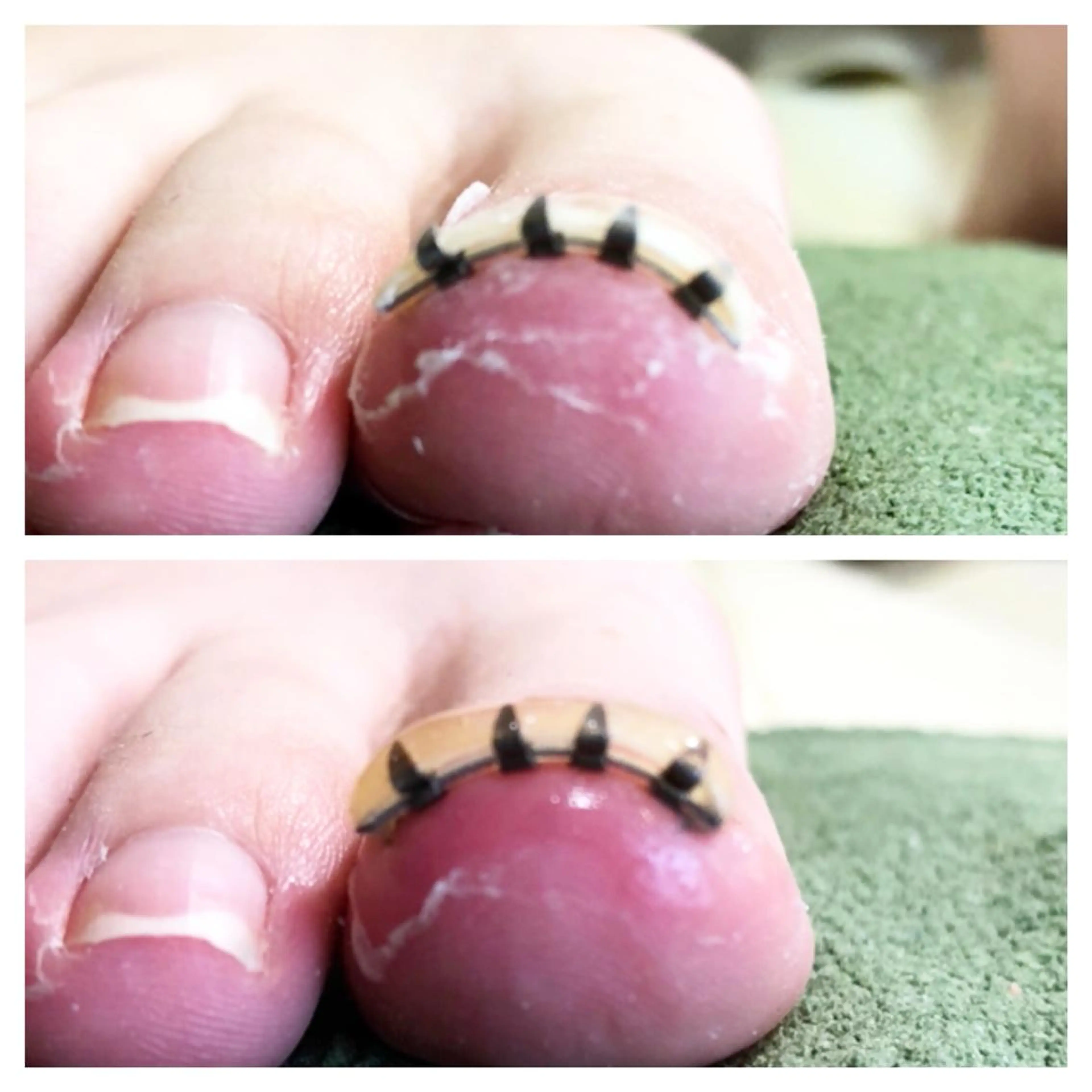 メンズ ネイル クリアネイル 🌱 ま し お 🌱のその他イメージ