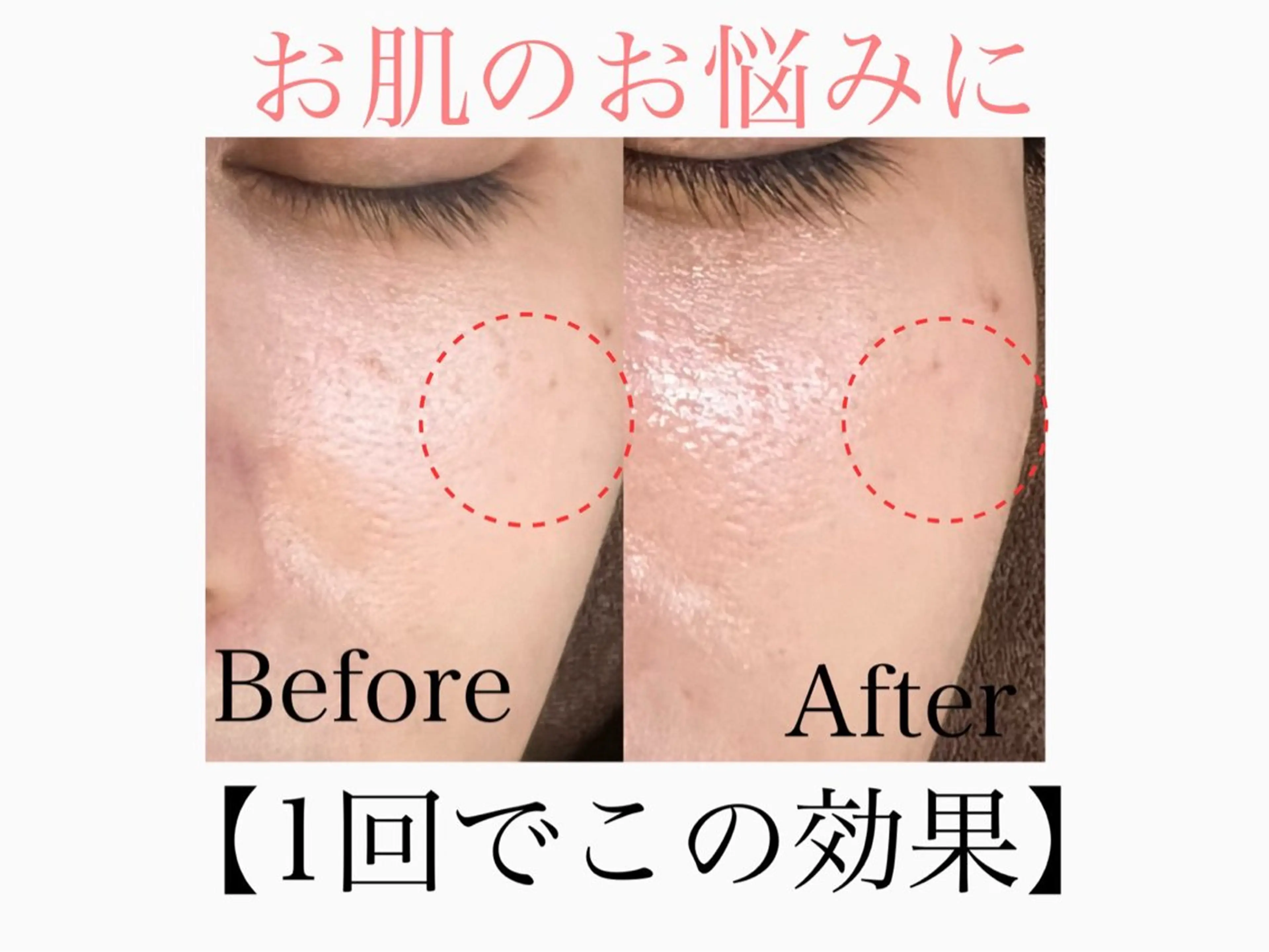 エステ 六本木脱毛andS 店長Sachiのエステ・リラクイメージ