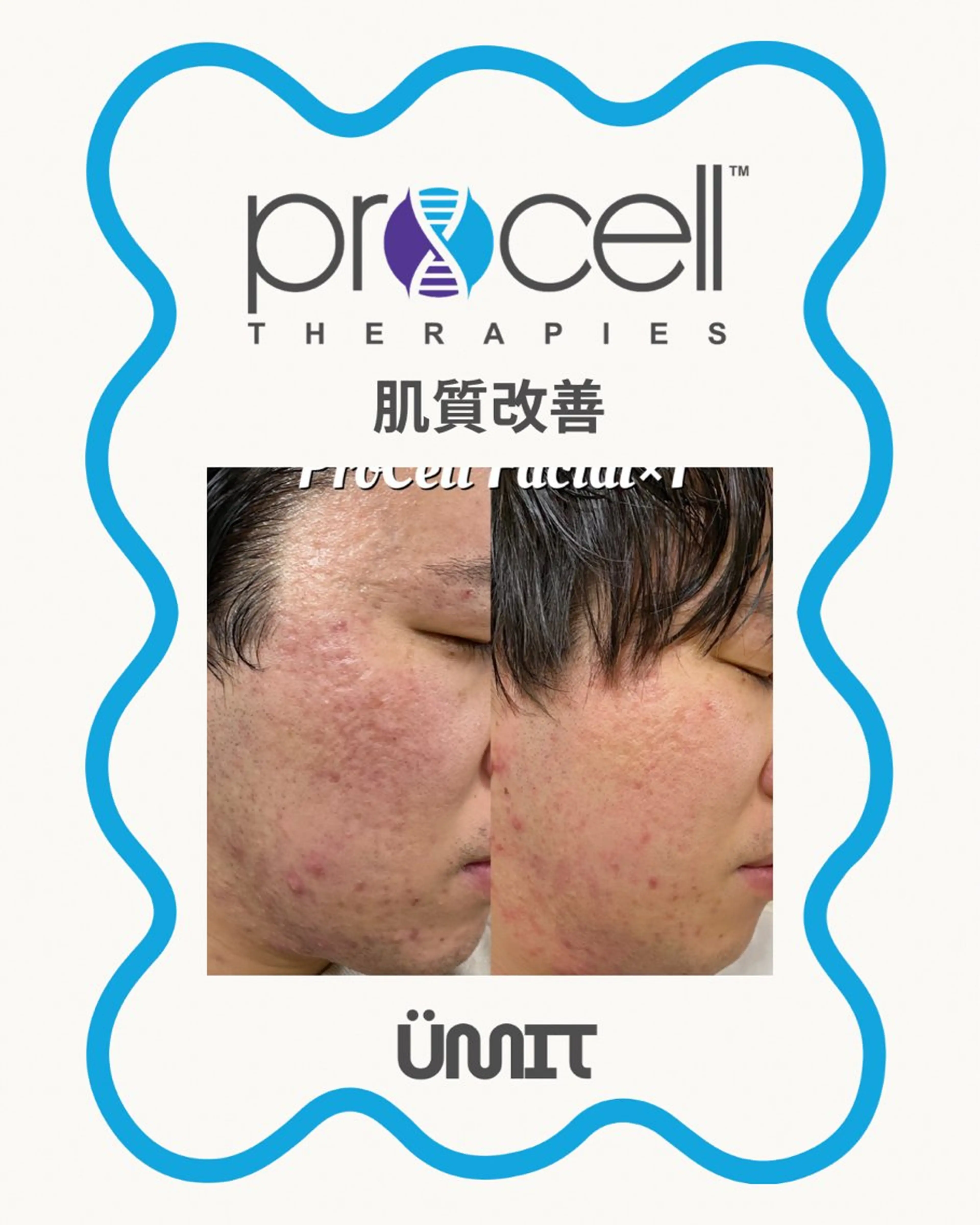 メンズ エステ Ümit（ユミト） プロセルセラピーズのヘアスタイル