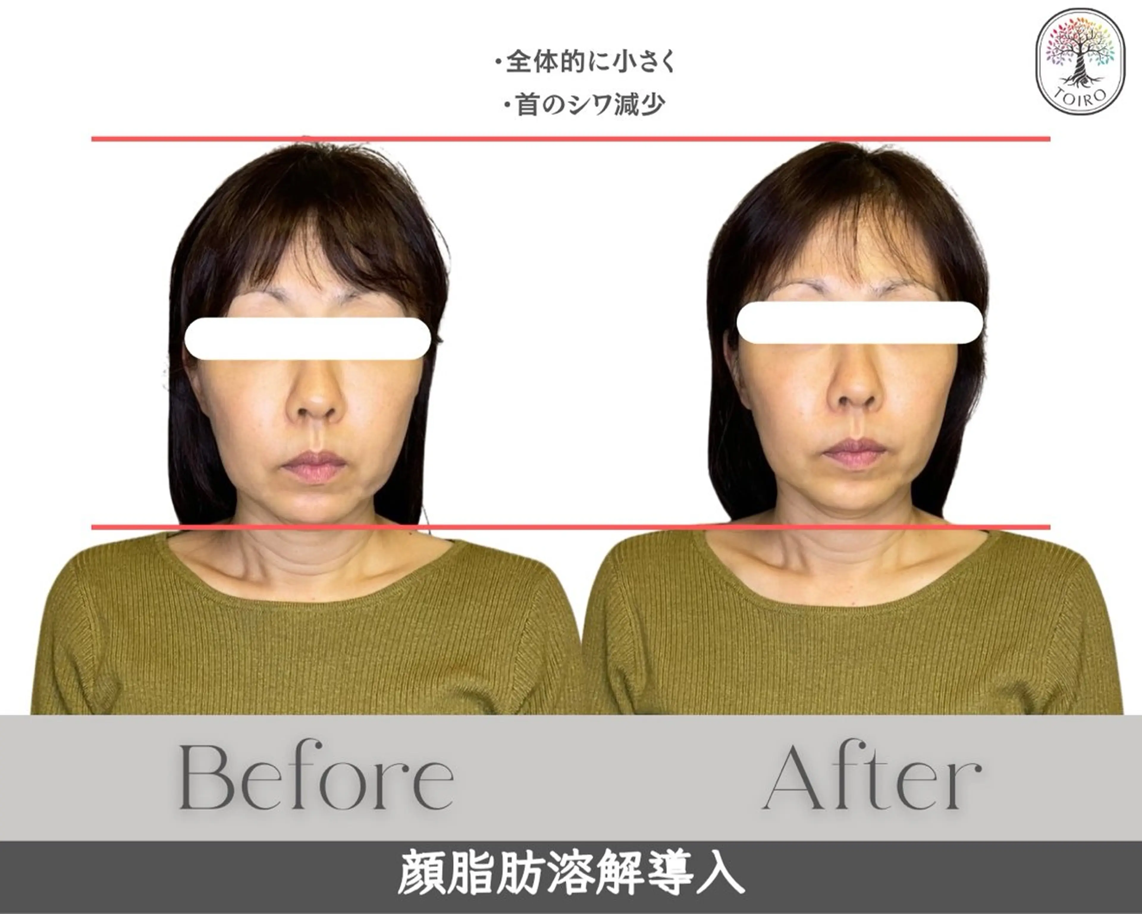 ヘッドスパ・小顔矯正　十色　横浜所属・ヘッドスパ・小顔矯正 十色　横浜のエステ・リラクイメージ