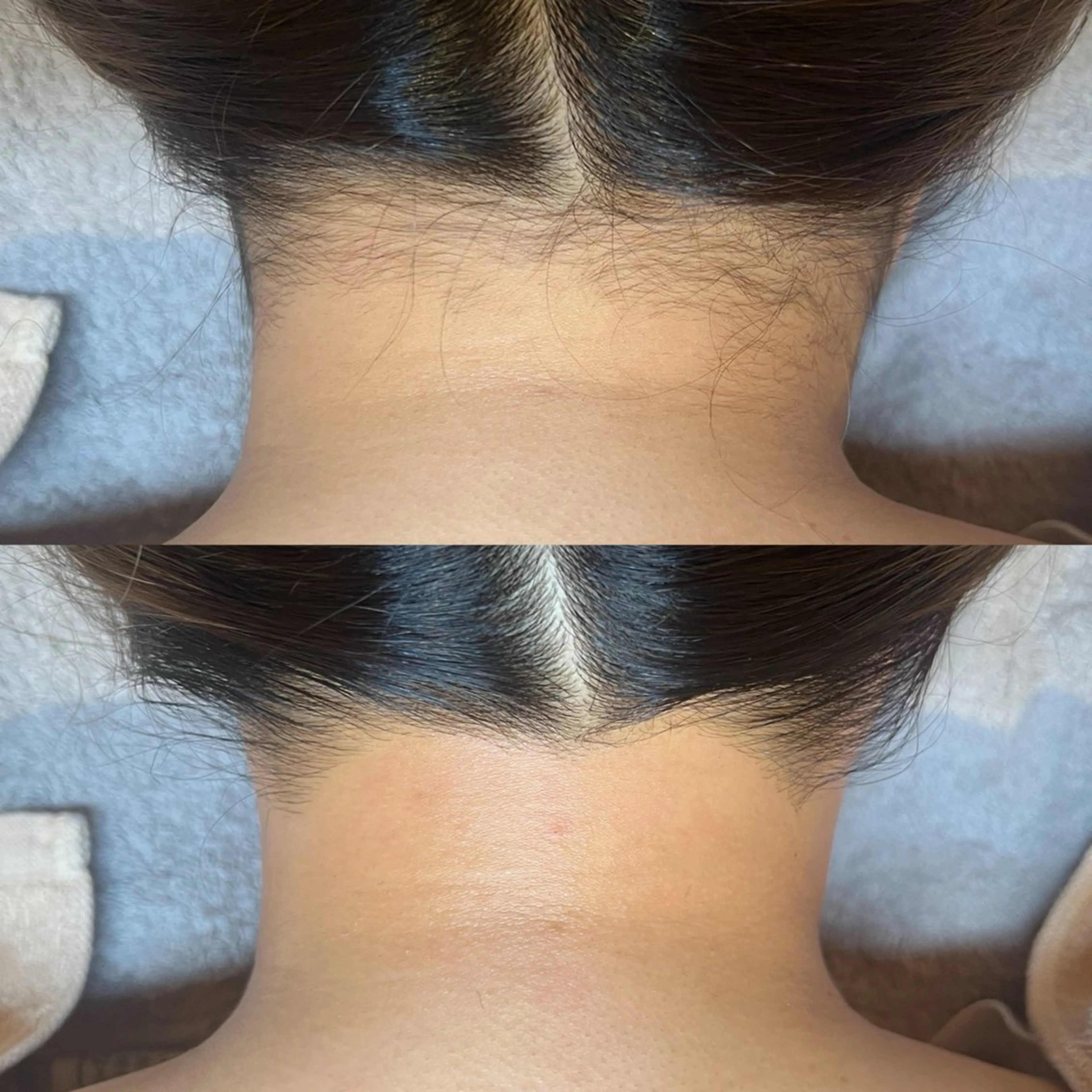 脱毛・肌質改善サロン Linoのエステ・リラクイメージ