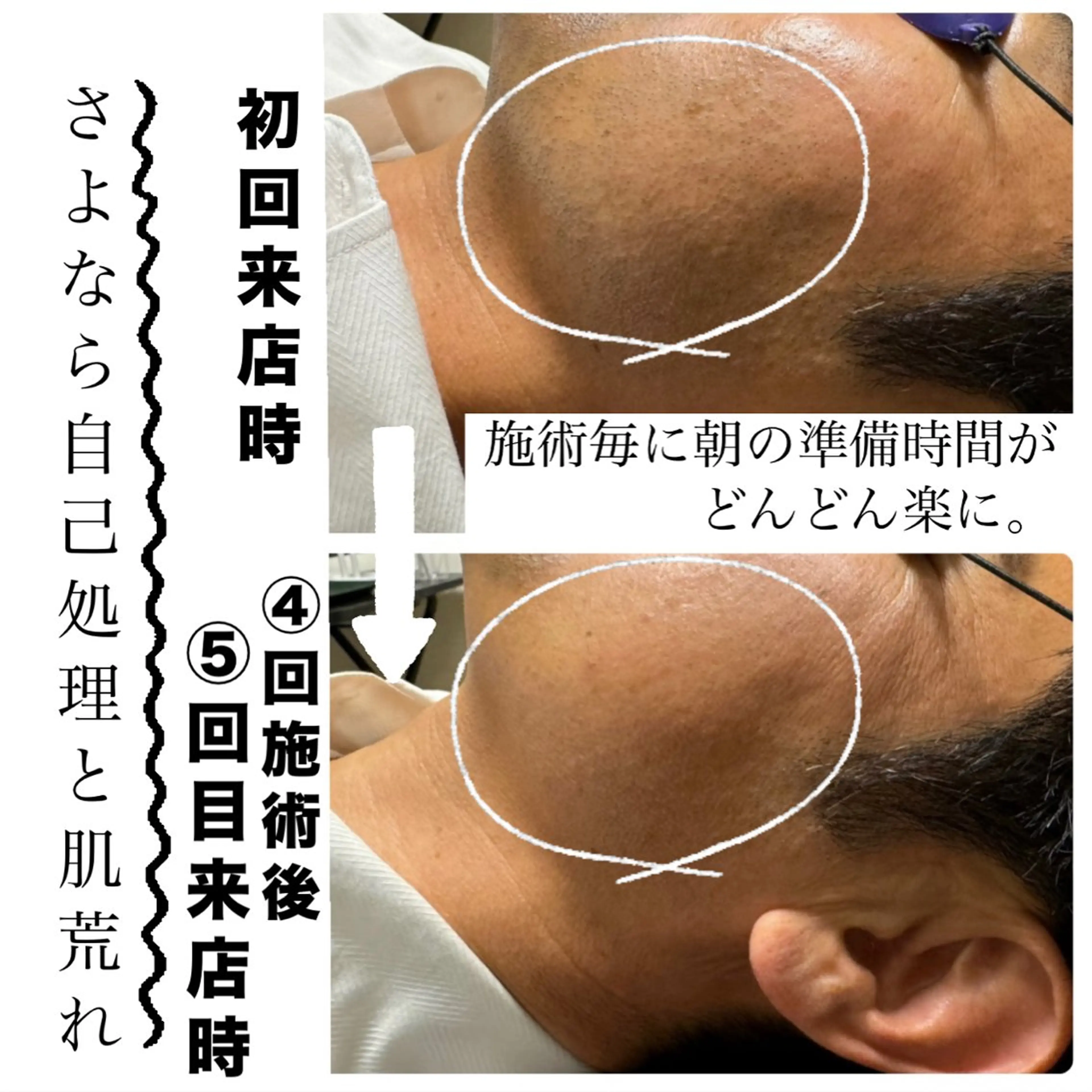 メンズ 脱毛 メンズ脱毛サロン Le falcoのエステ・リラクイメージ