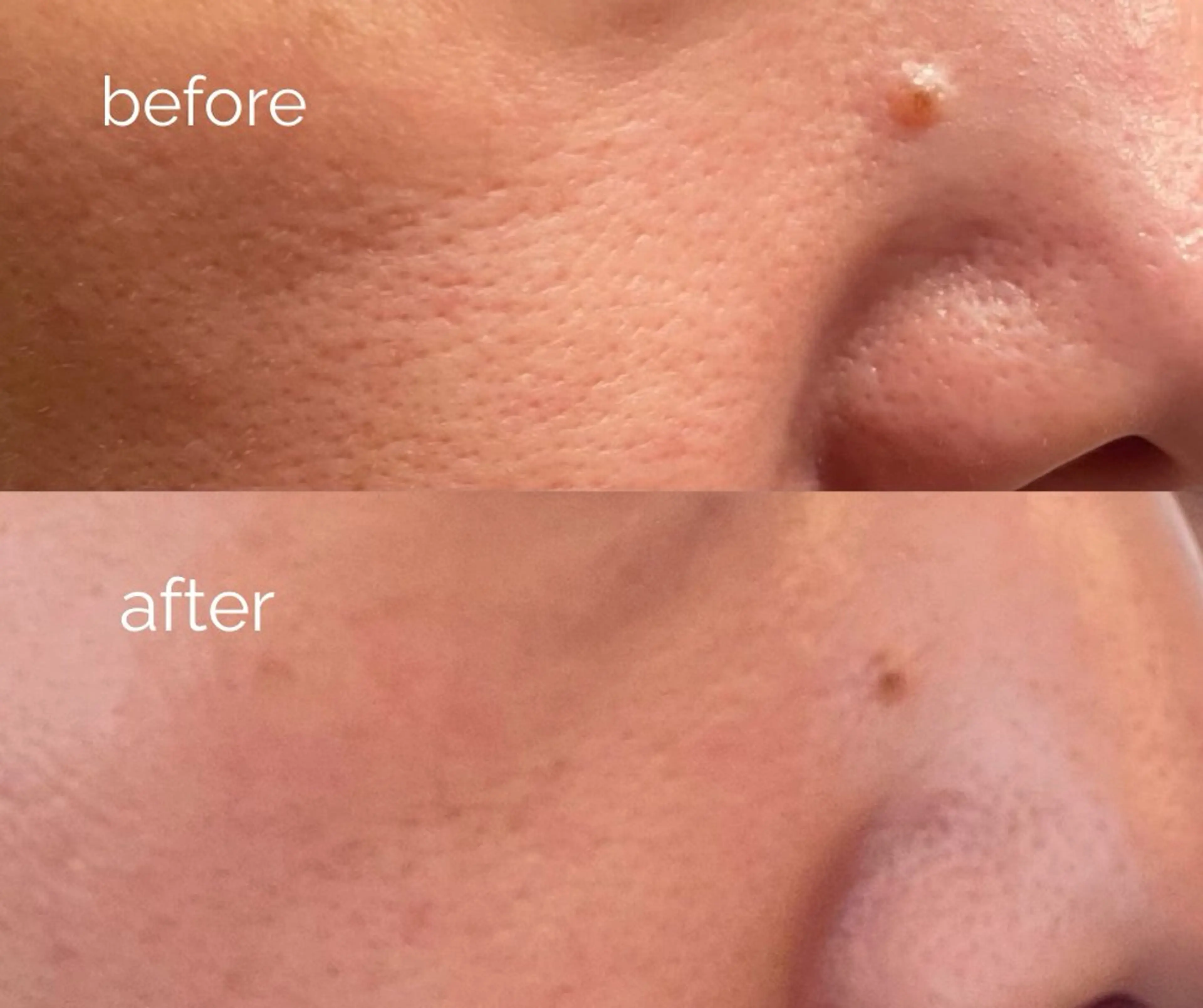 毛穴ケア専門サロン m&uのエステ・リラクイメージ