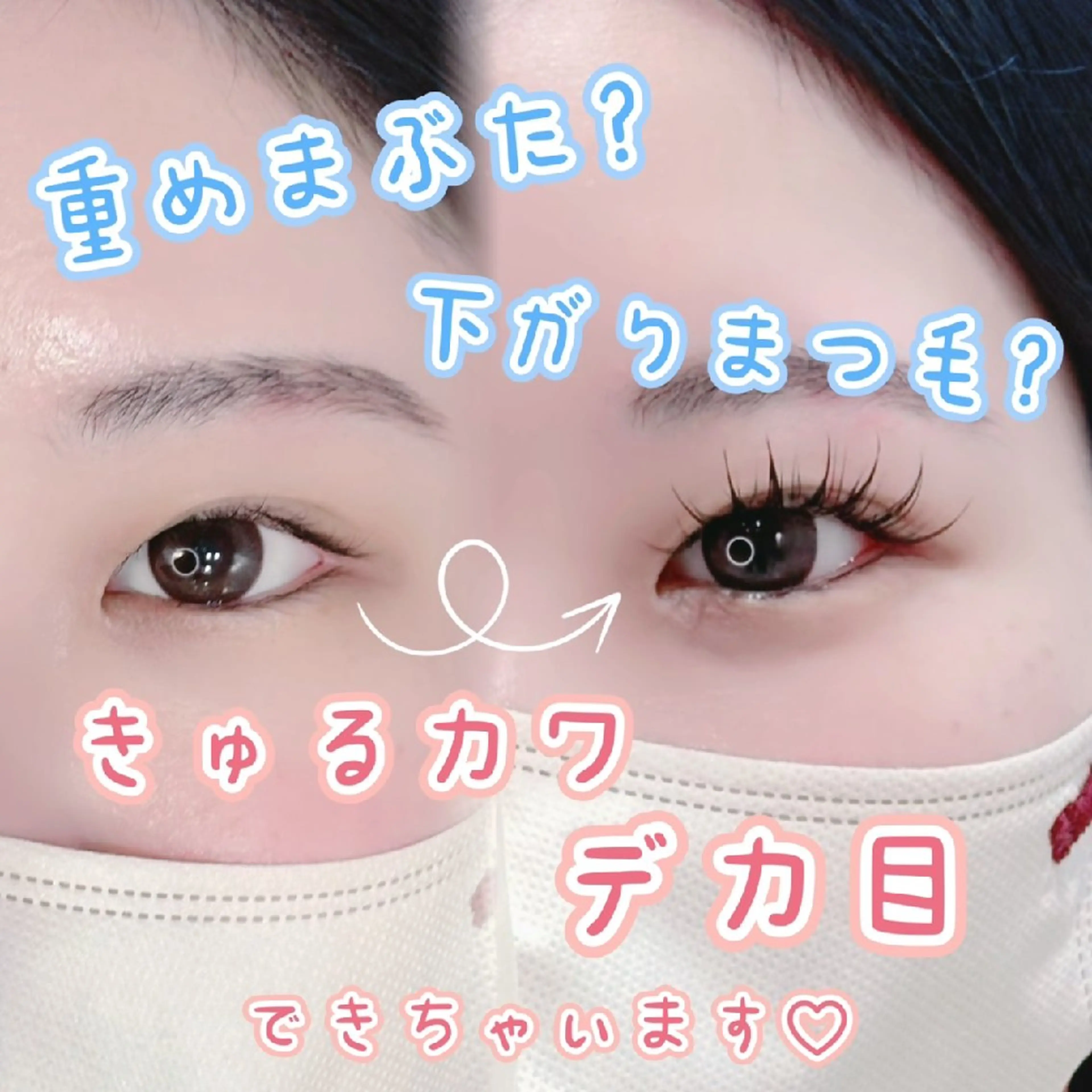 アンドヘルシー🎀下がりまつ毛の方必見❣️エクステ×パーマの写真