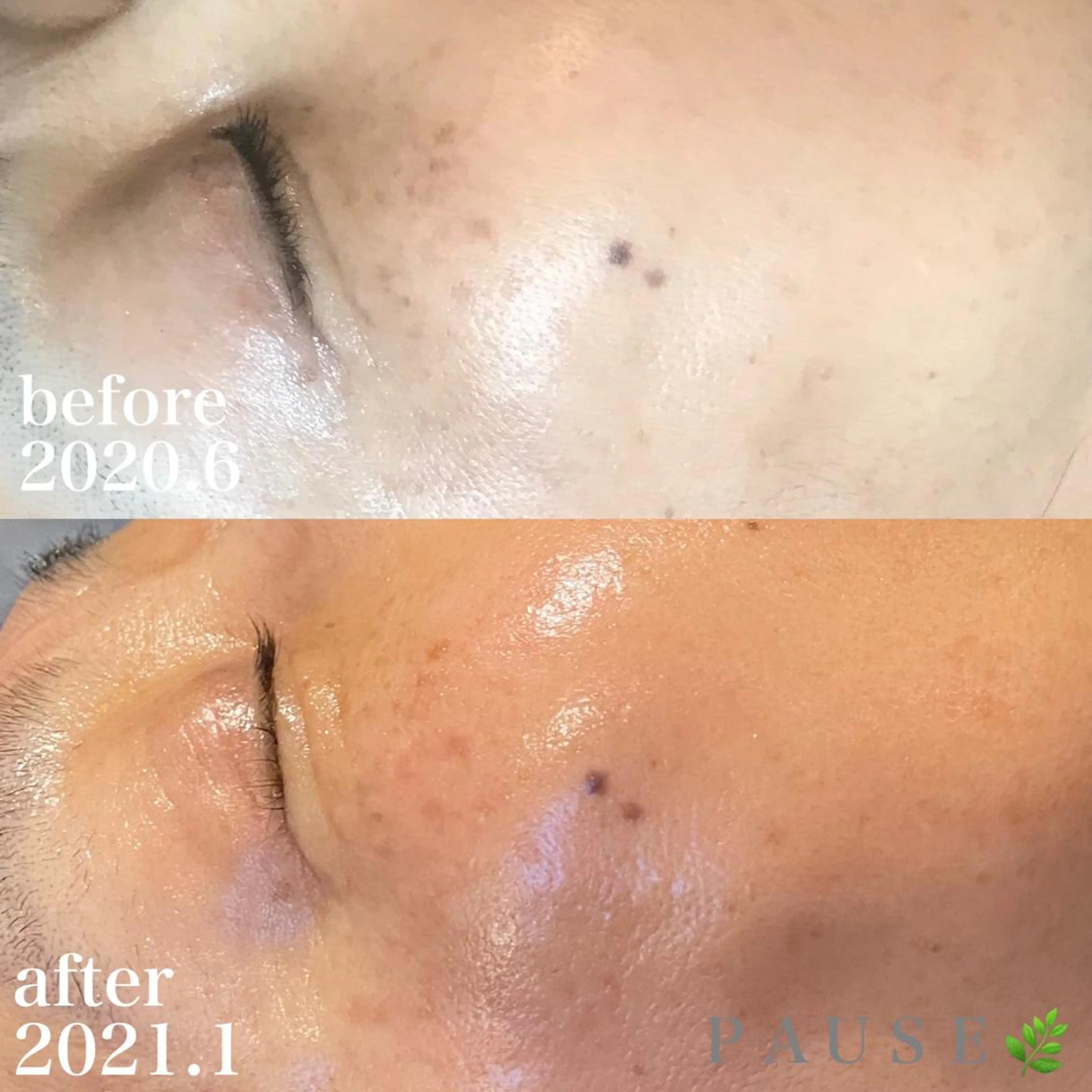 エステ 浜野 恵美のエステ・リラクイメージ