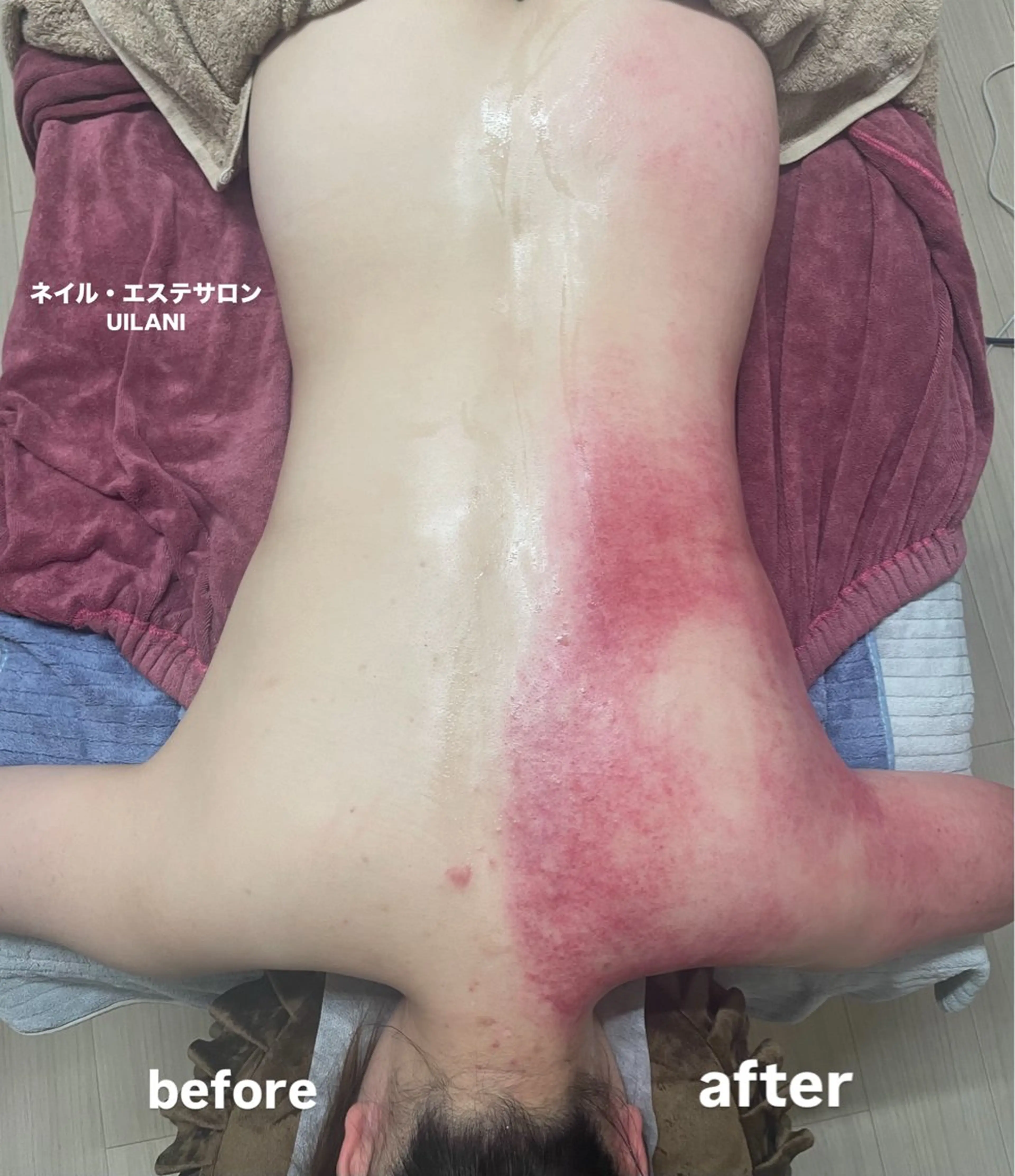 エステ リラク ネイル・エステサロンUILANI所属・ネイル・エステサロン UILANIのネイルデザイン