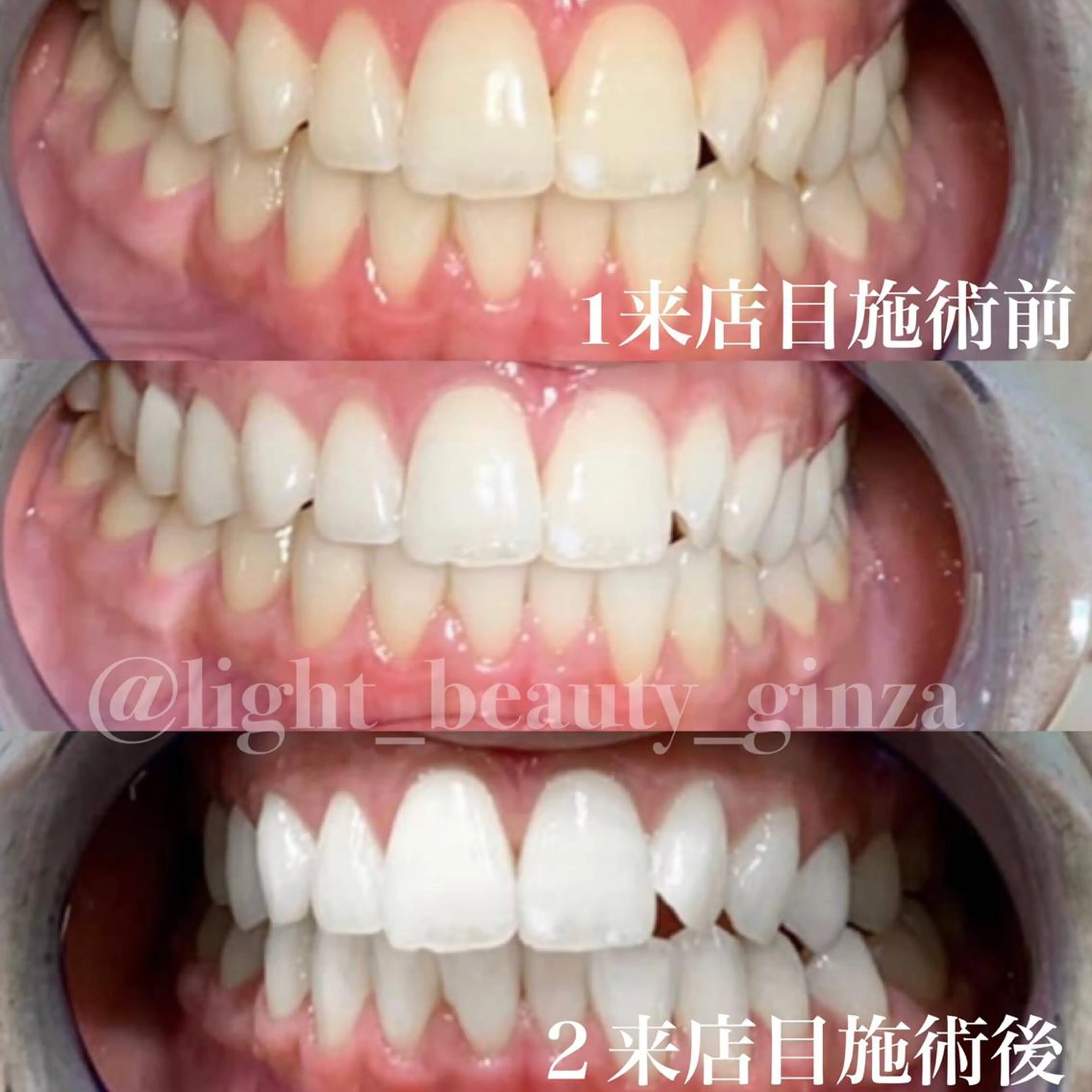 エステ リラク ライトビューティー 銀座店のエステ・リラクイメージ