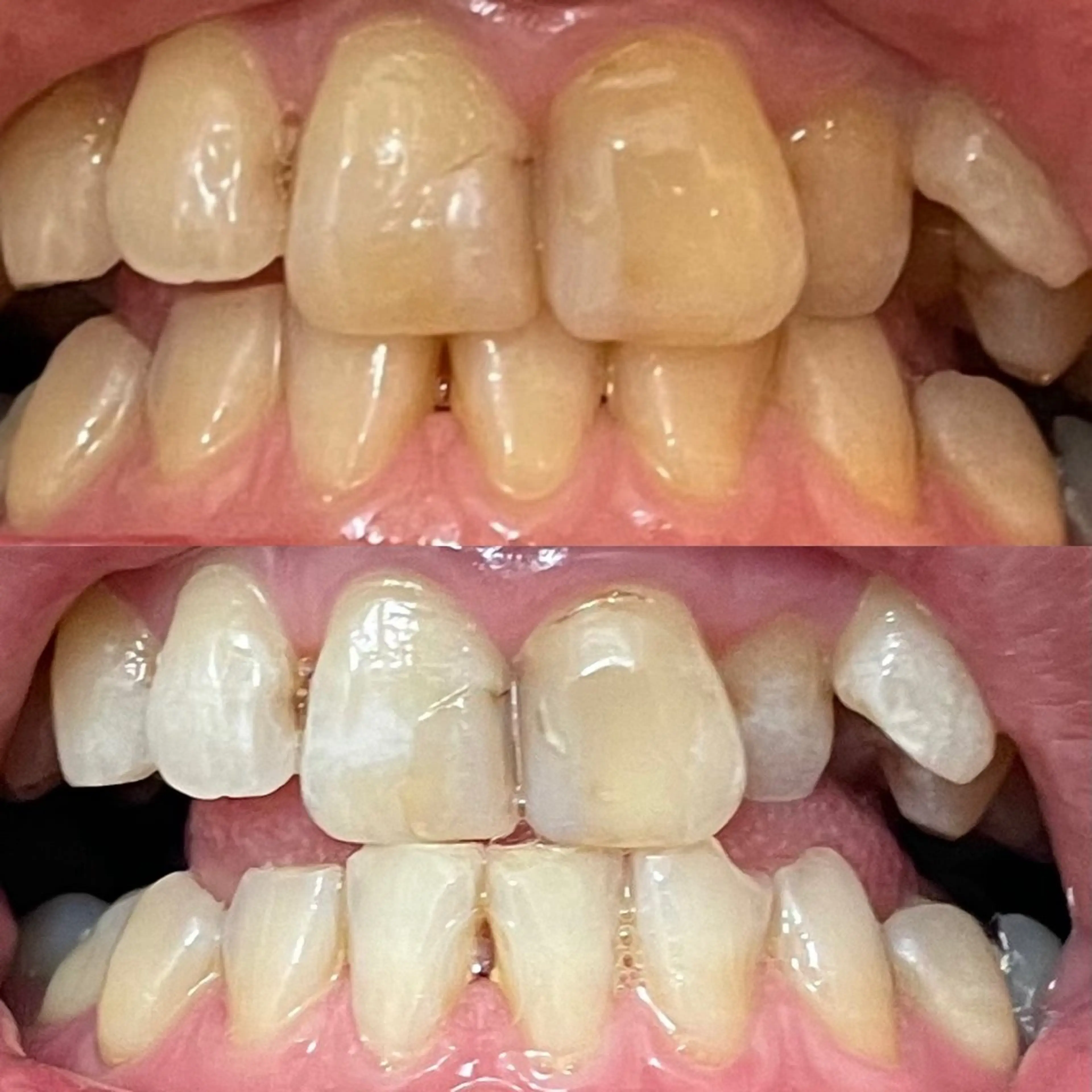 その他 MEE ｜MIHOのその他イメージ