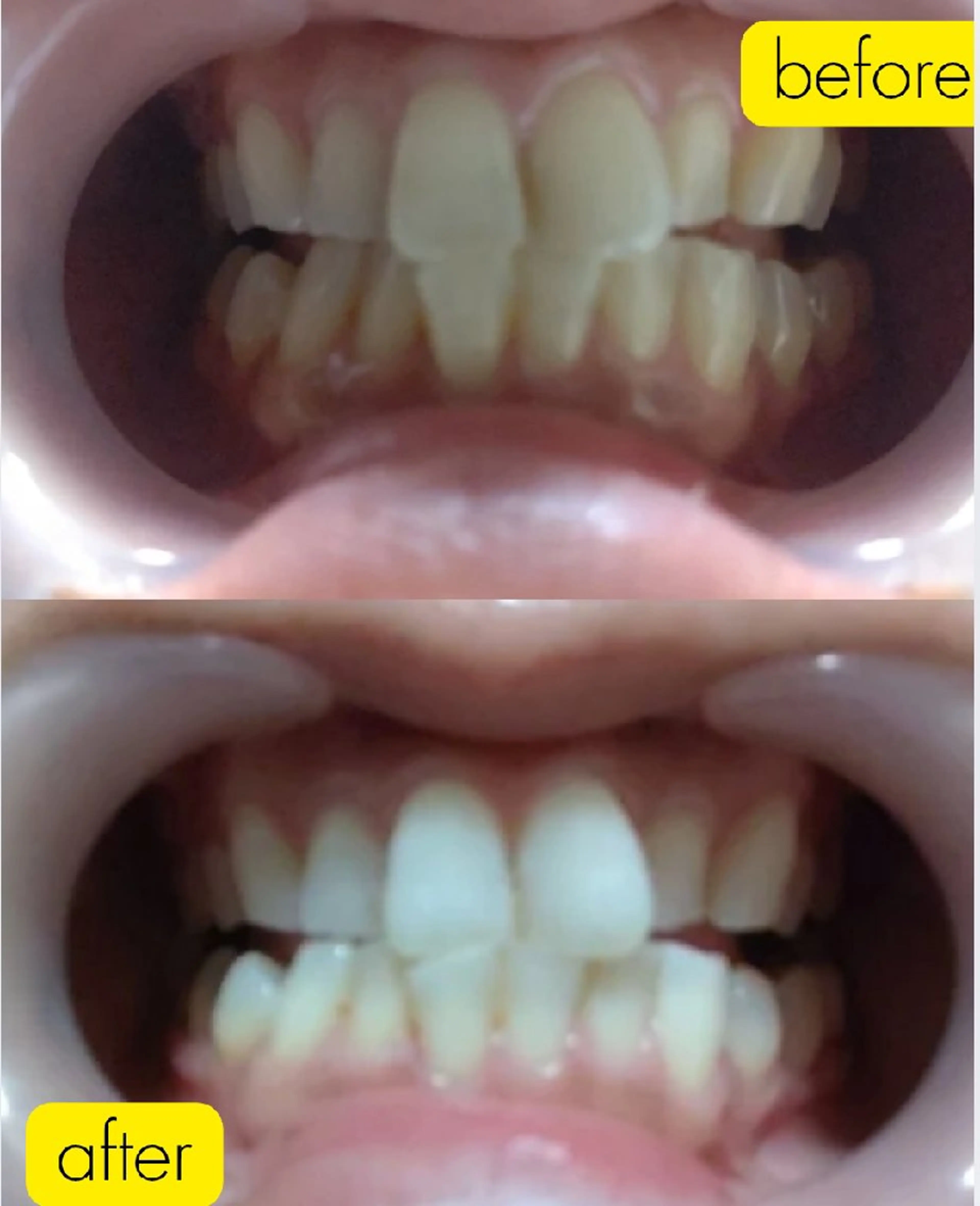 その他 はなえみの森所属・上戸 千瑞のエステ・リラクイメージ