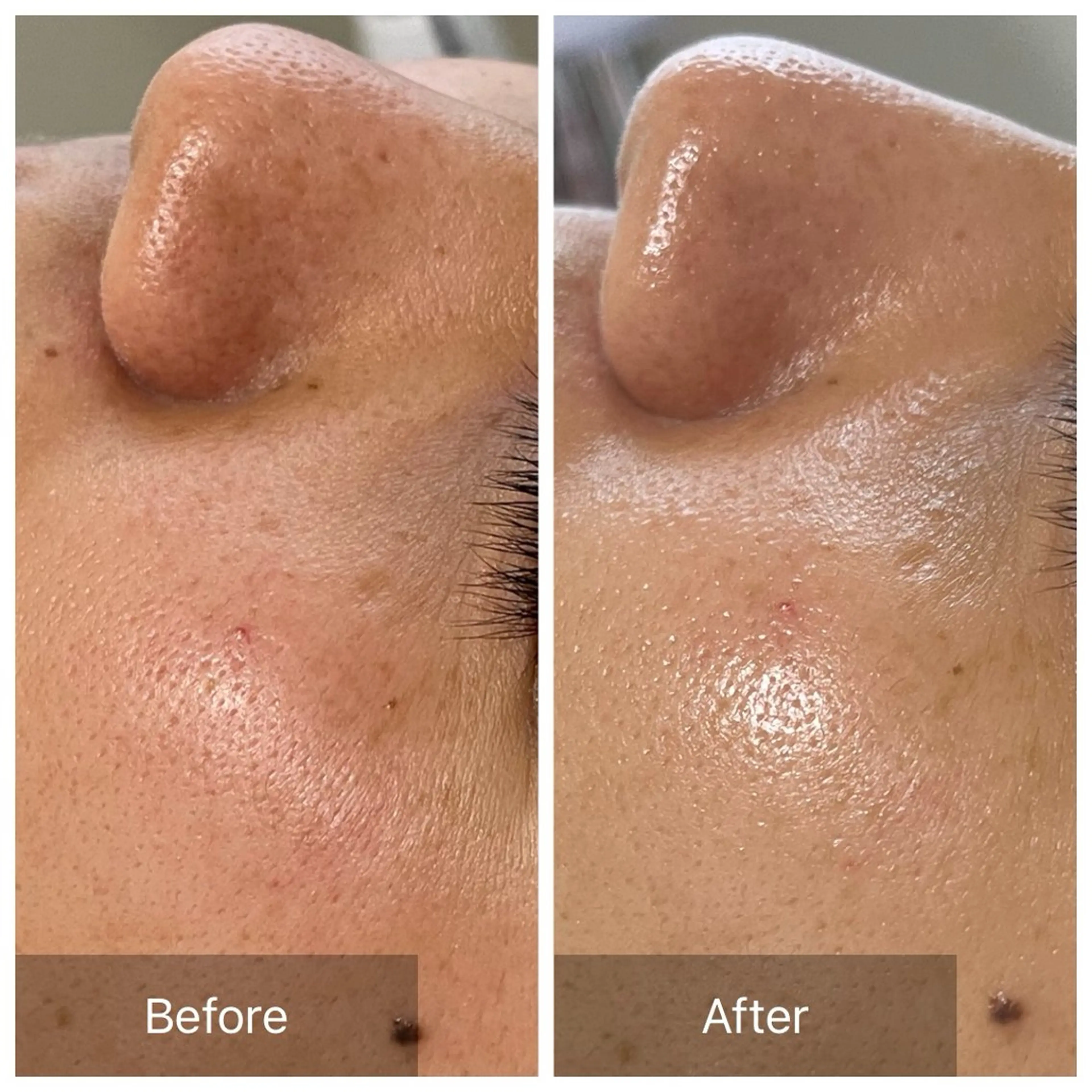 毛穴が見えなくなるサロン  Horo所属・岡 えり子のエステ・リラクイメージ