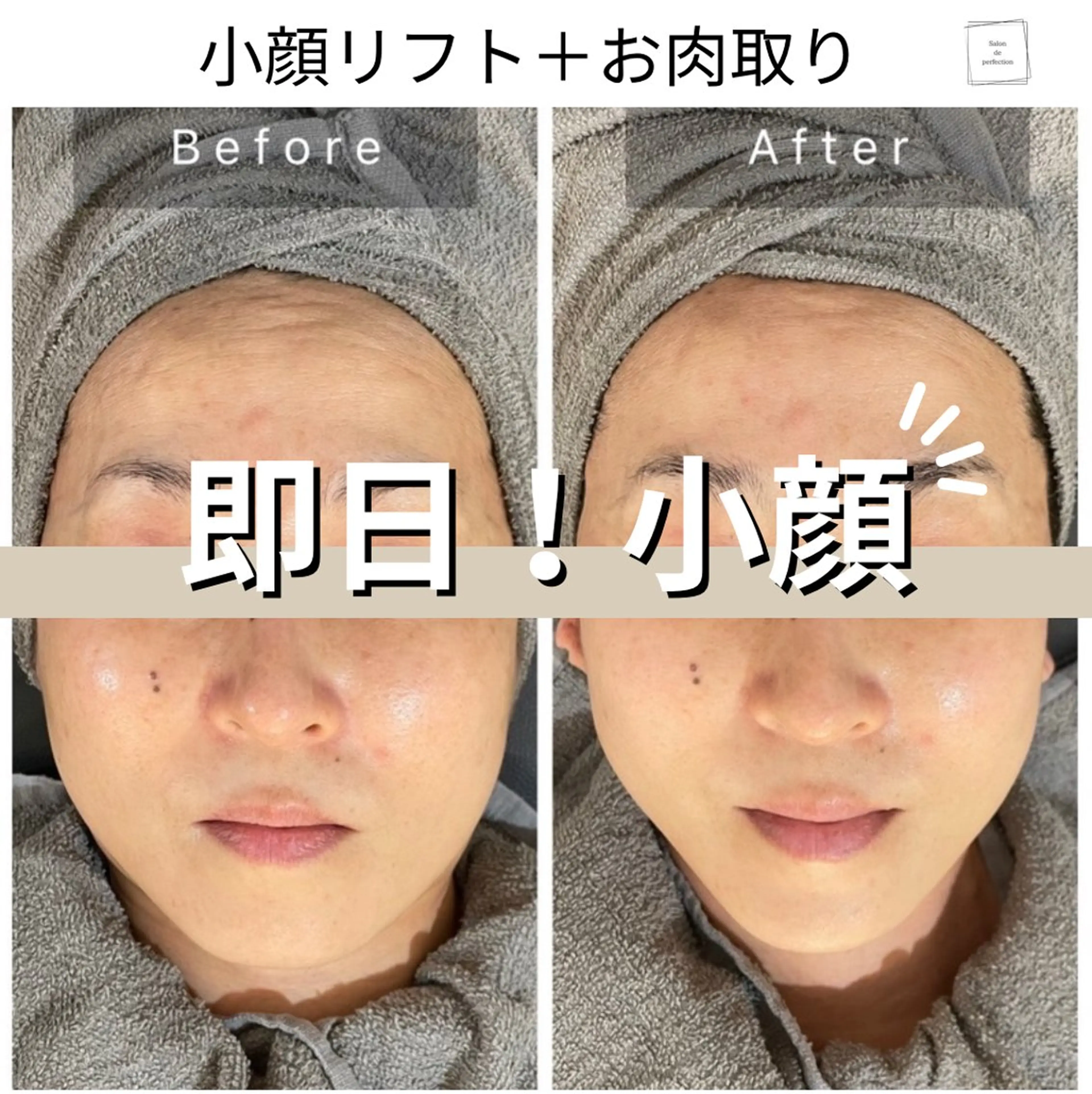 エステ salon de perfectionのエステ・リラクイメージ