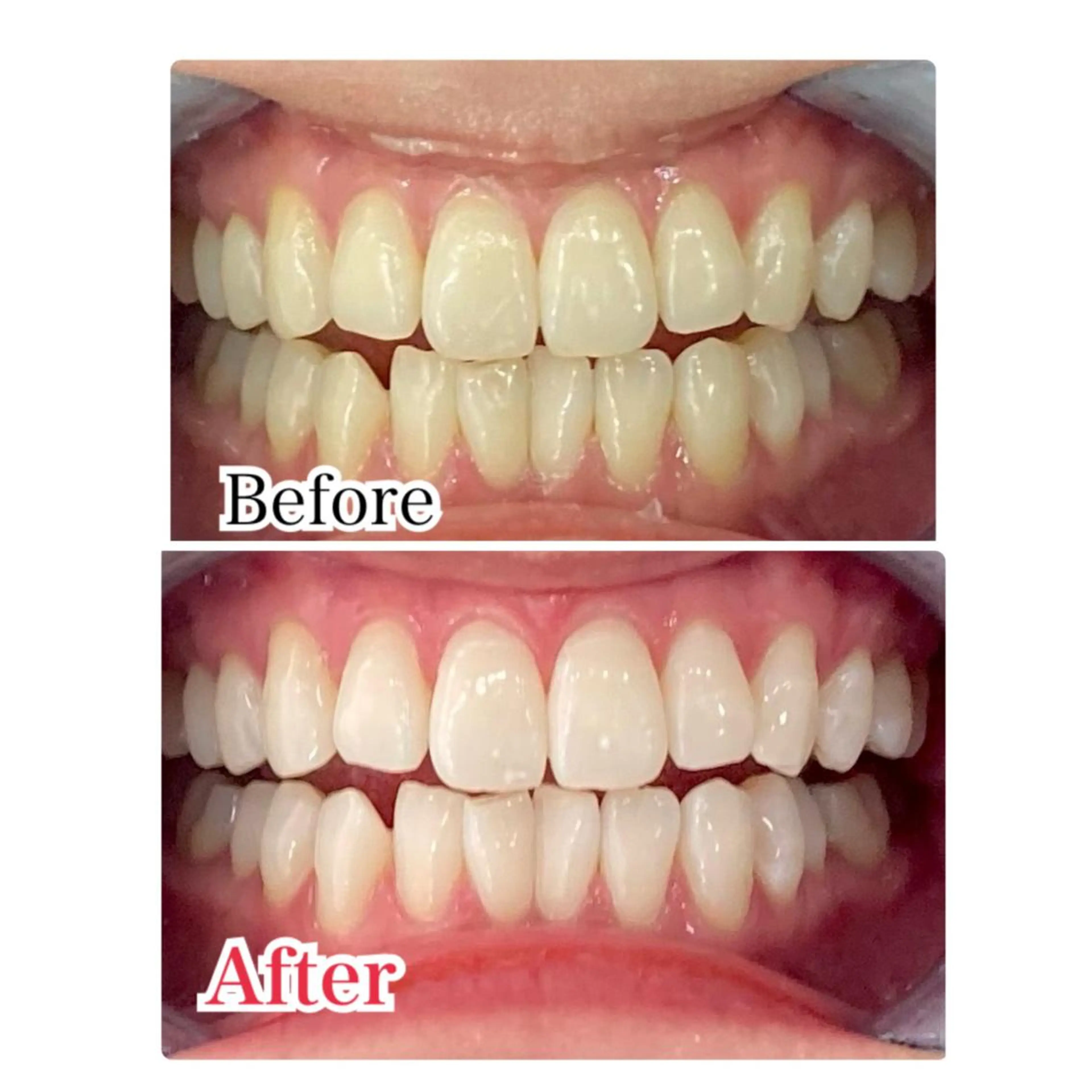 ネイル マツエク・マツパ アイブロウ ホワイト プラチナムビューティー柏所属・【歯科提携】柏ホワイ トニングスタイルのその他イメージ