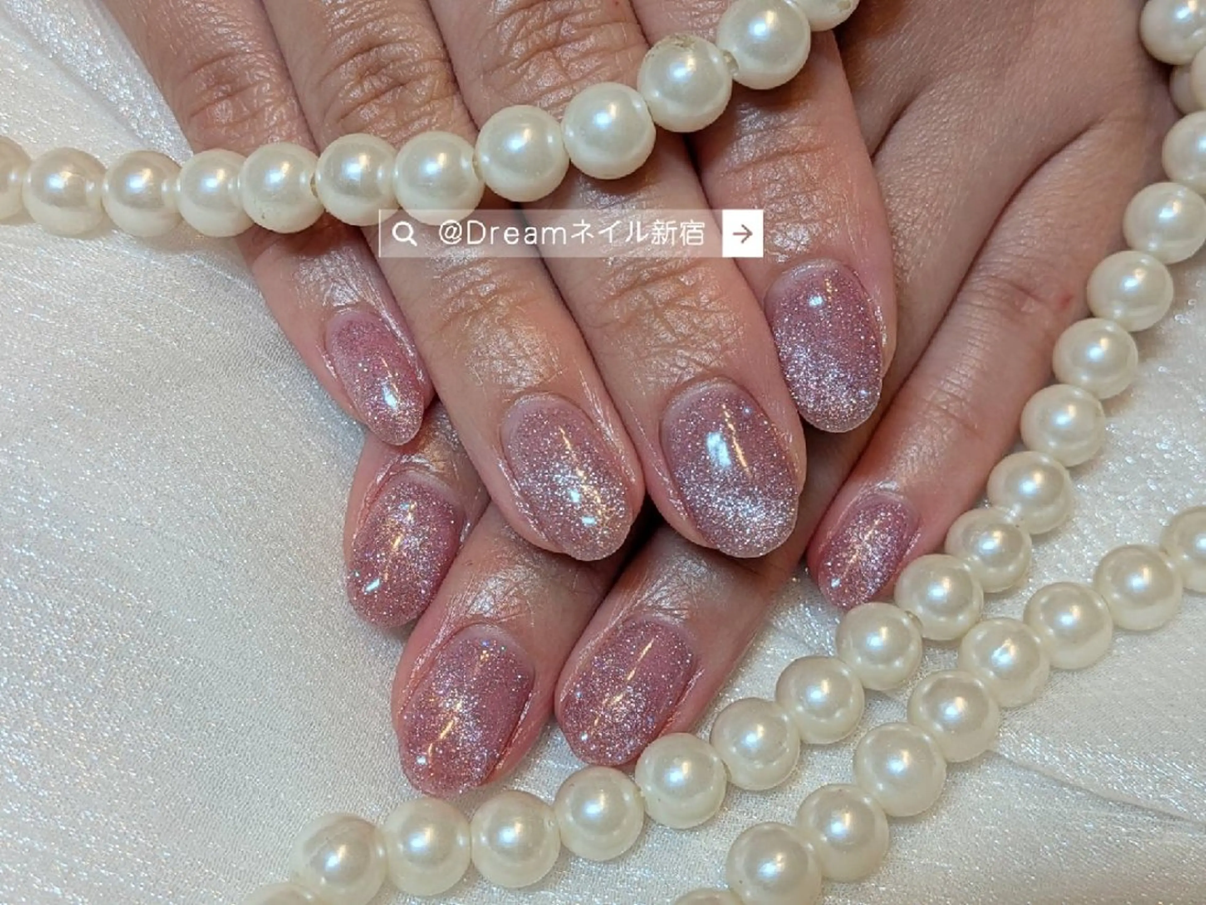 ネイル ハンドネイル ネイリストゆか💅 長さだし、深爪矯正のネイルデザイン