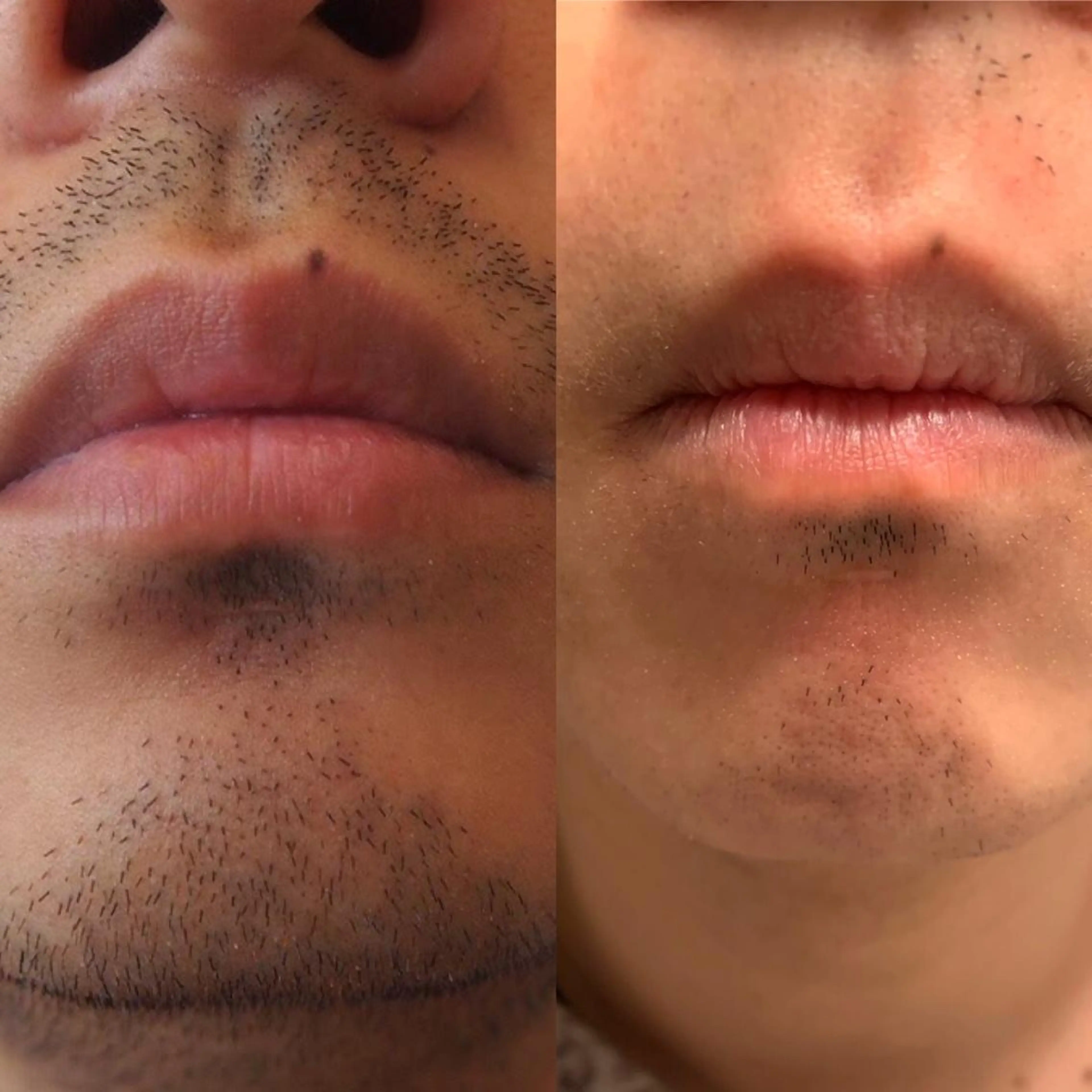 山口 裕輝のエステ・リラクイメージ