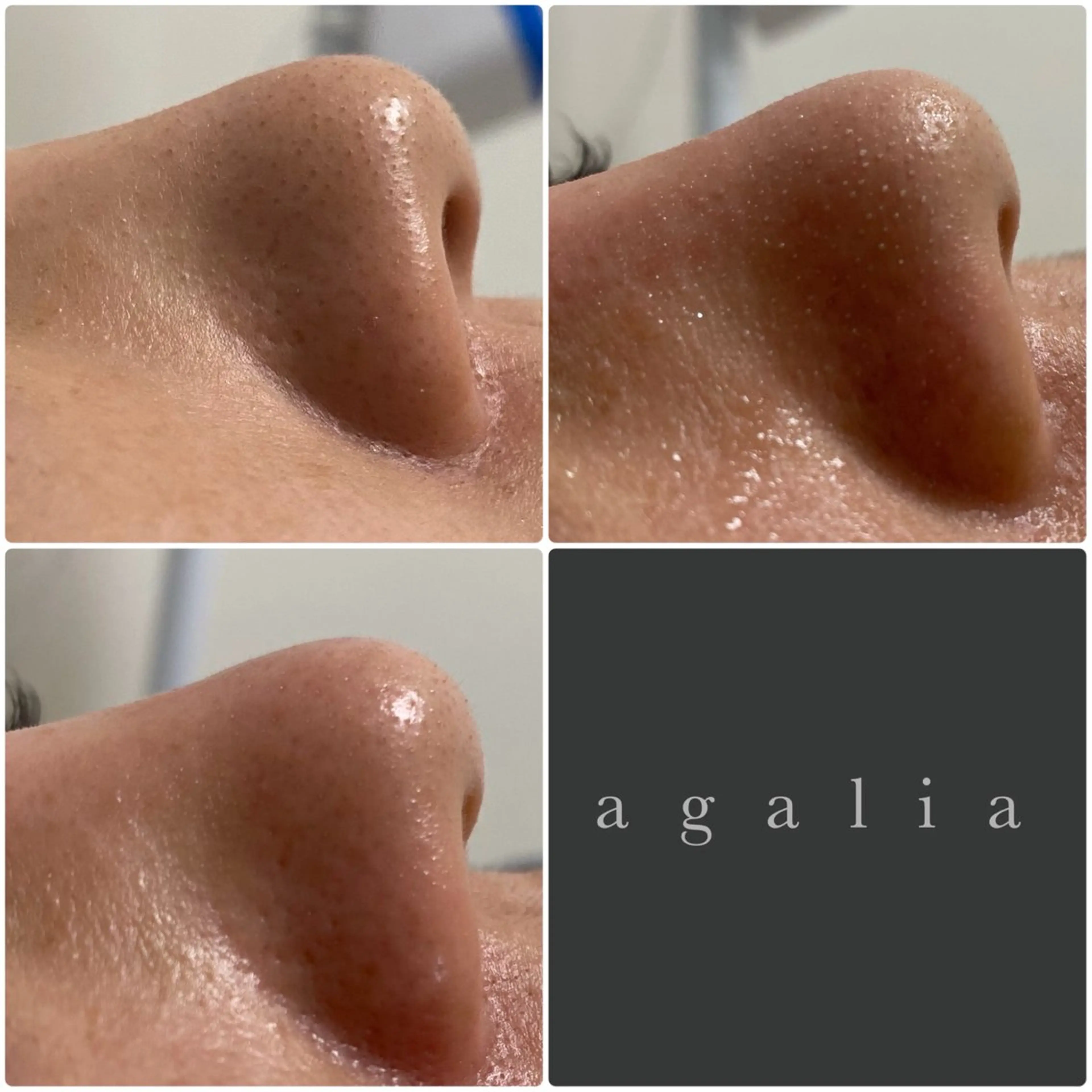 agalia所属・都度払いサロン 【agalia】のエステ・リラクイメージ