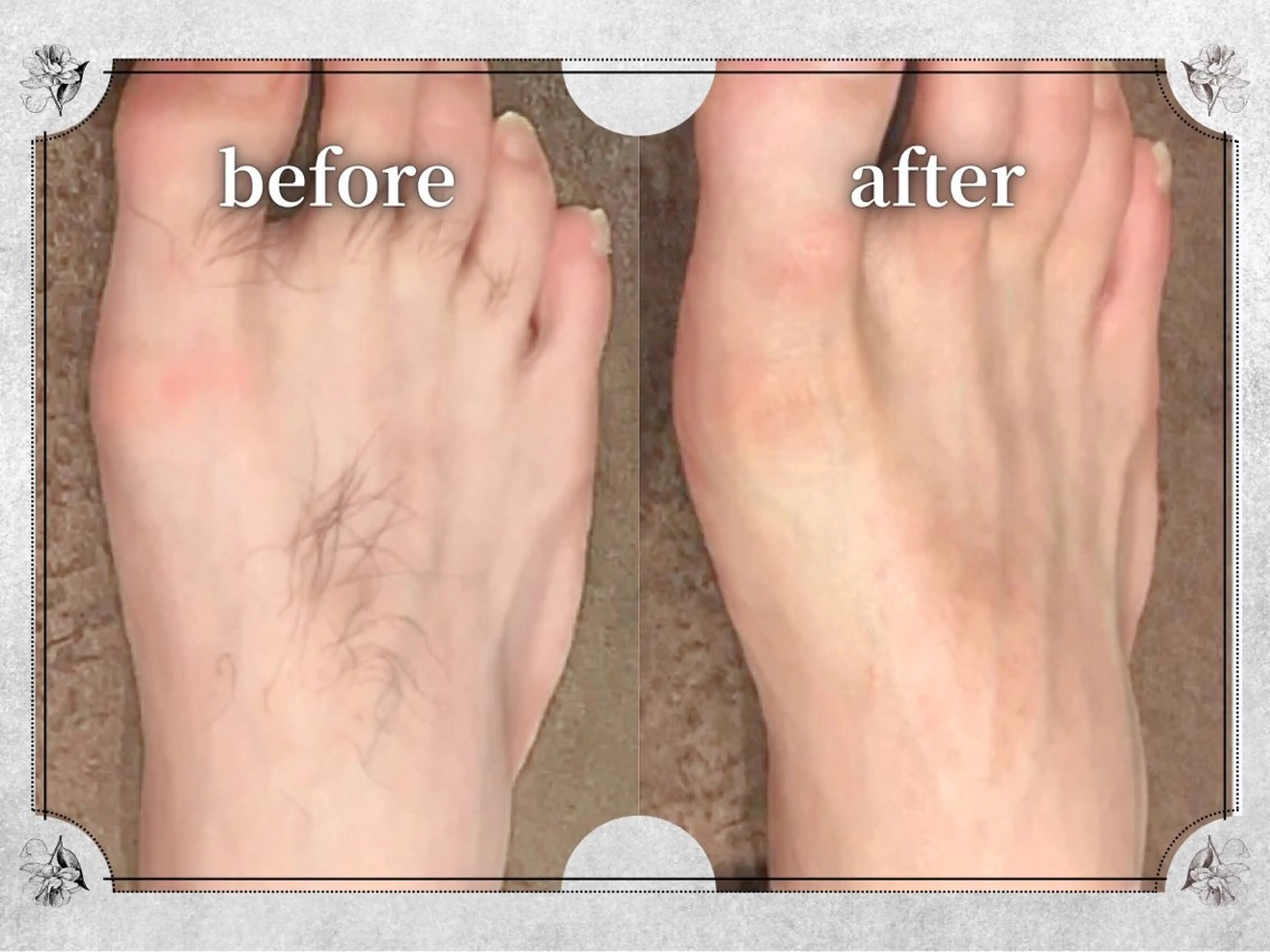 都度払い 脱毛 Lino柏/moeのエステ・リラクイメージ