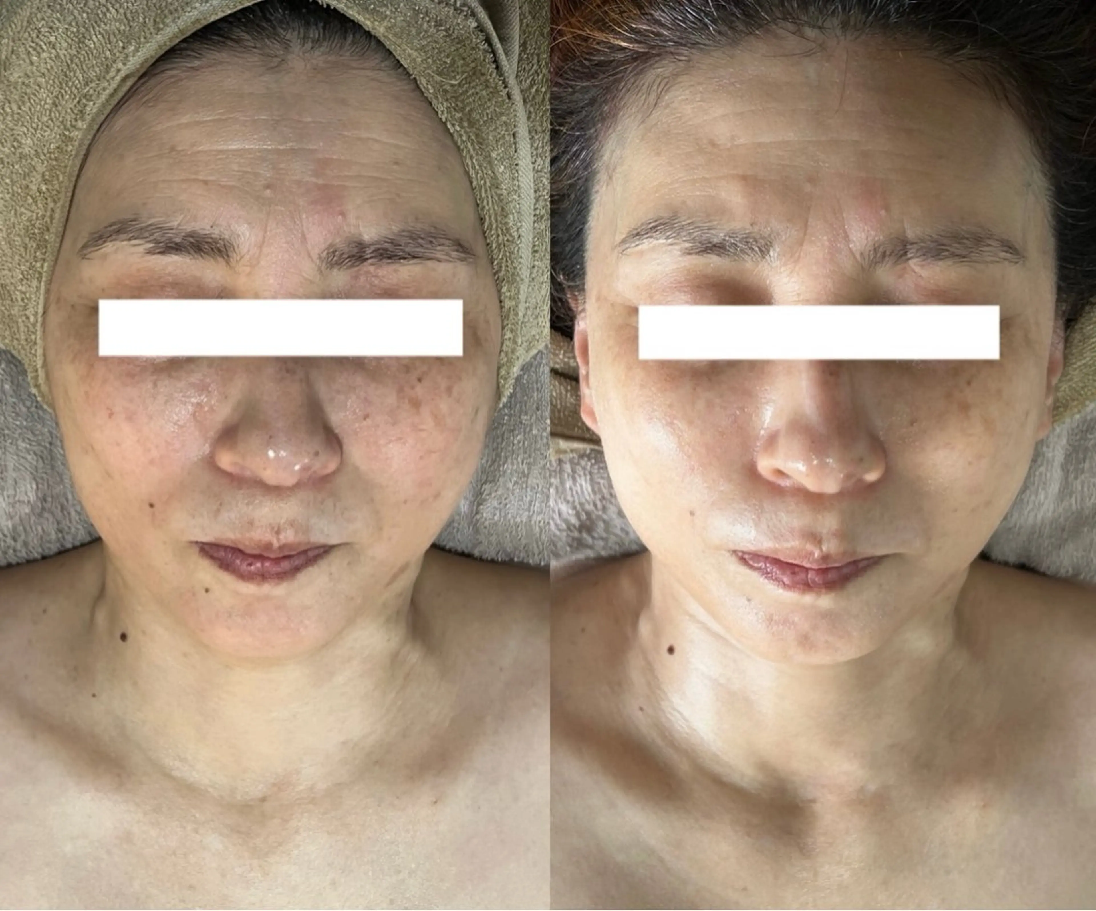 salon de   Be所属・salondeBe 🩵フェイシャル専門のエステ・リラクイメージ