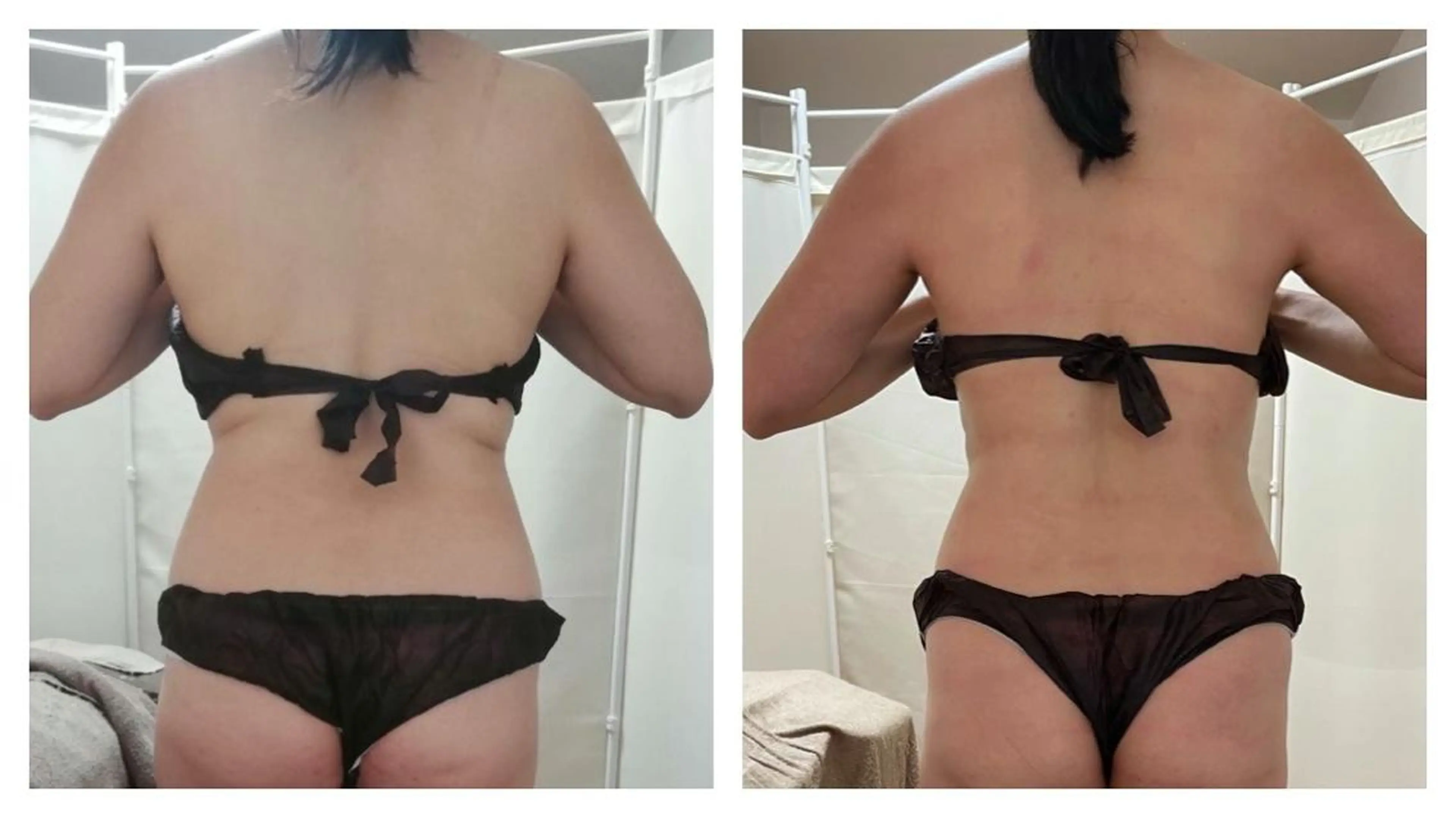 biloop所属・《痩身×疲労改善》 BILOOPのエステ・リラクイメージ