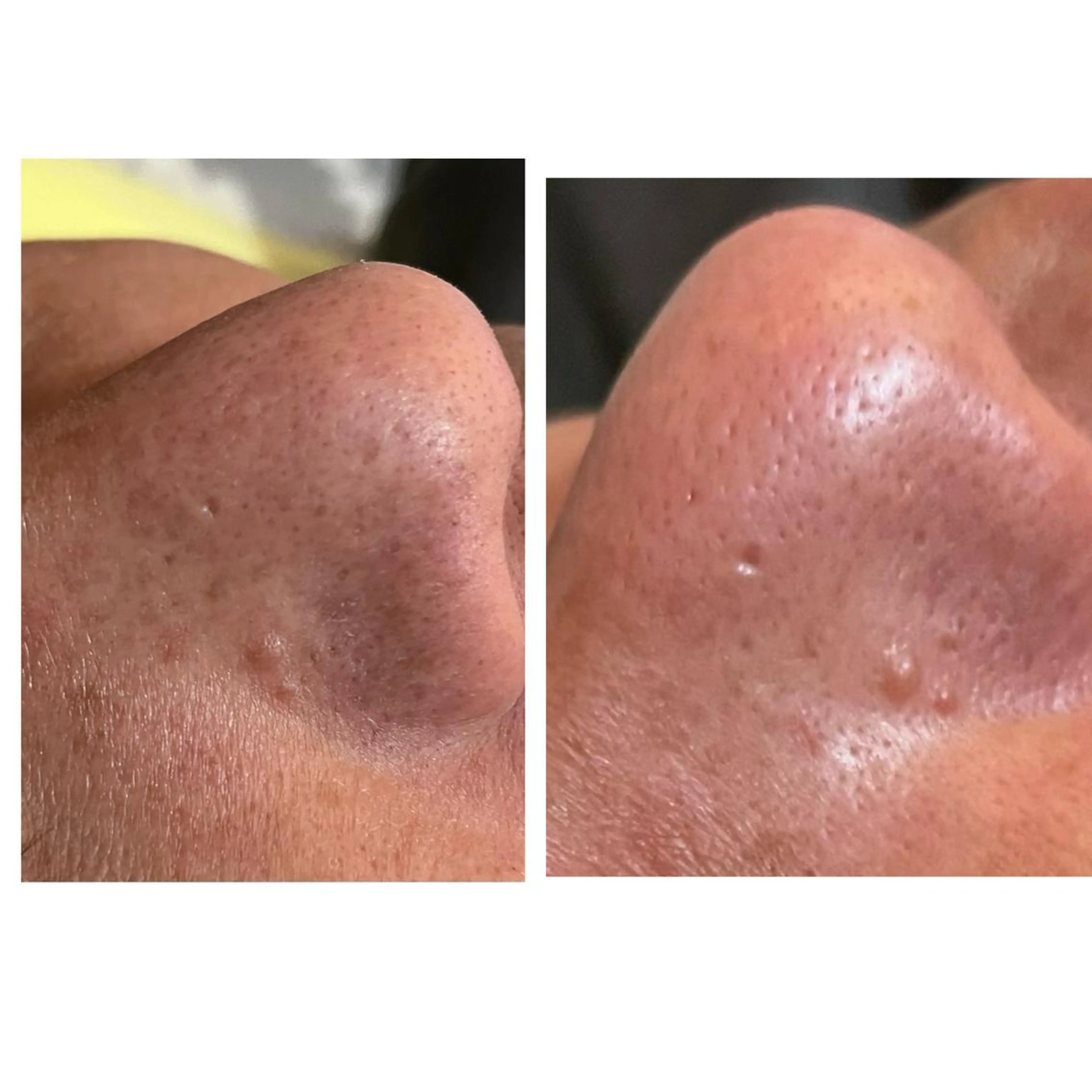 おうちサロン B-ROOMのエステ・リラクイメージ