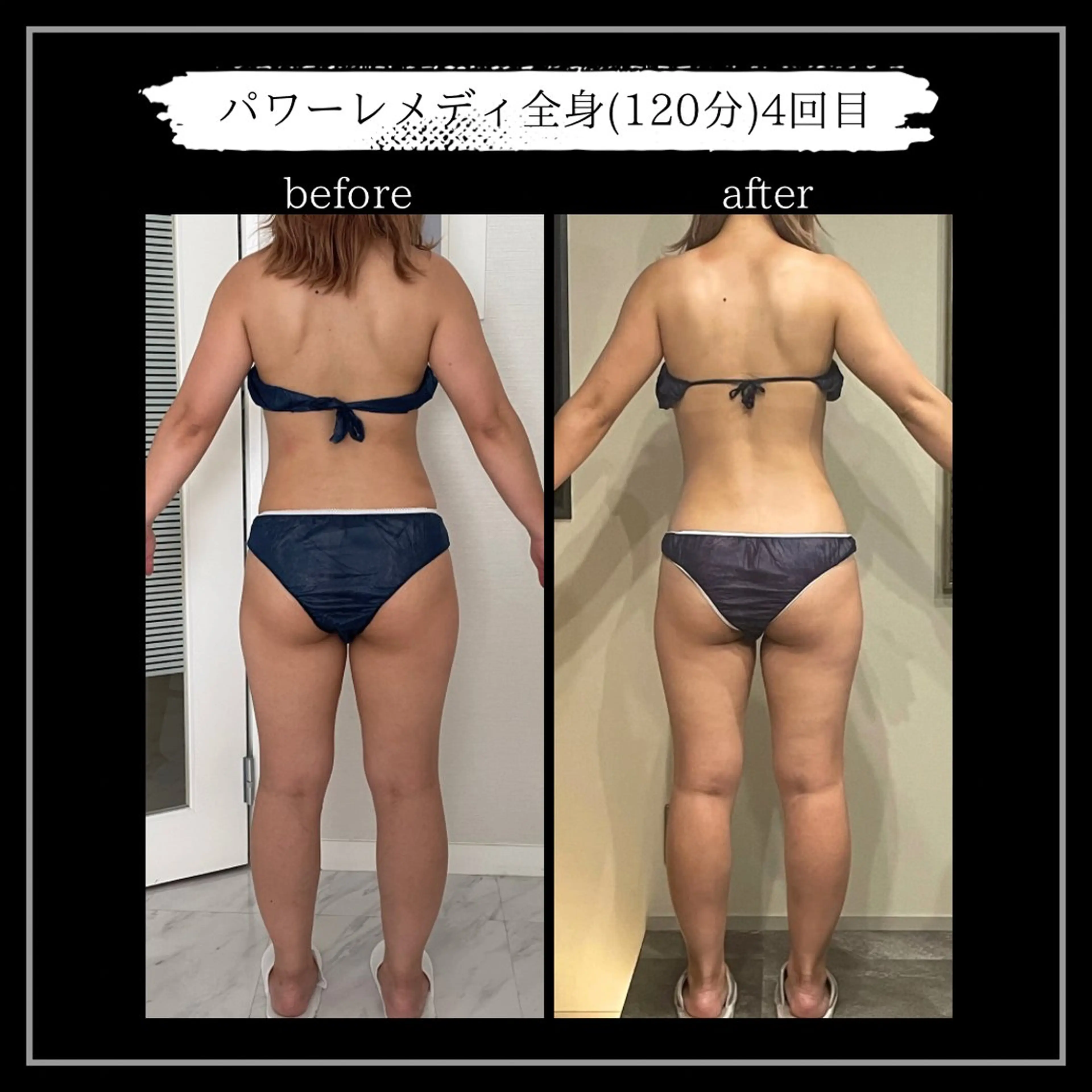 オフ:オン所属・オフ:オン 全身筋膜マッサージのエステ・リラクイメージ