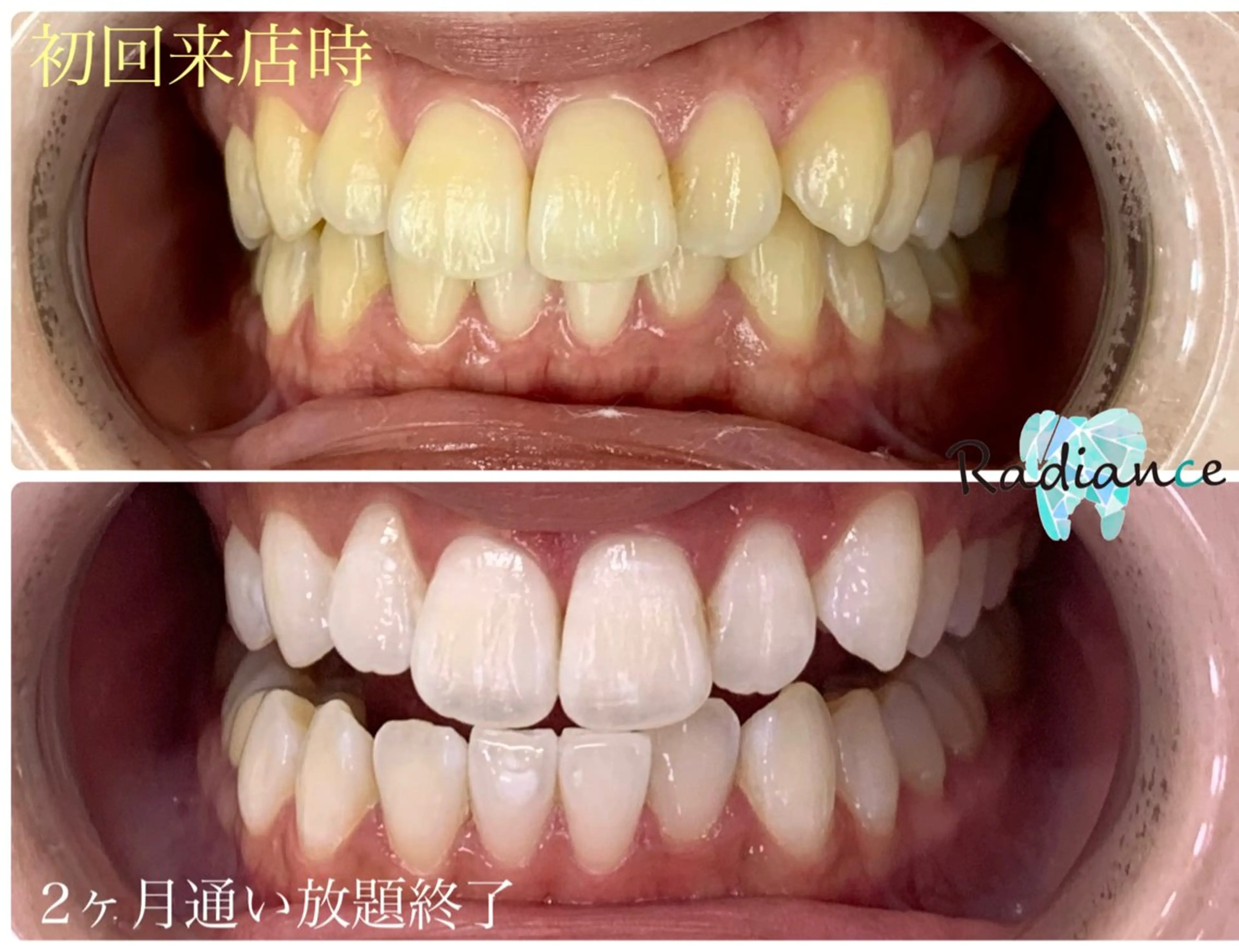 その他 札幌ホワイトニング ラディアンス札幌駅店のその他イメージ