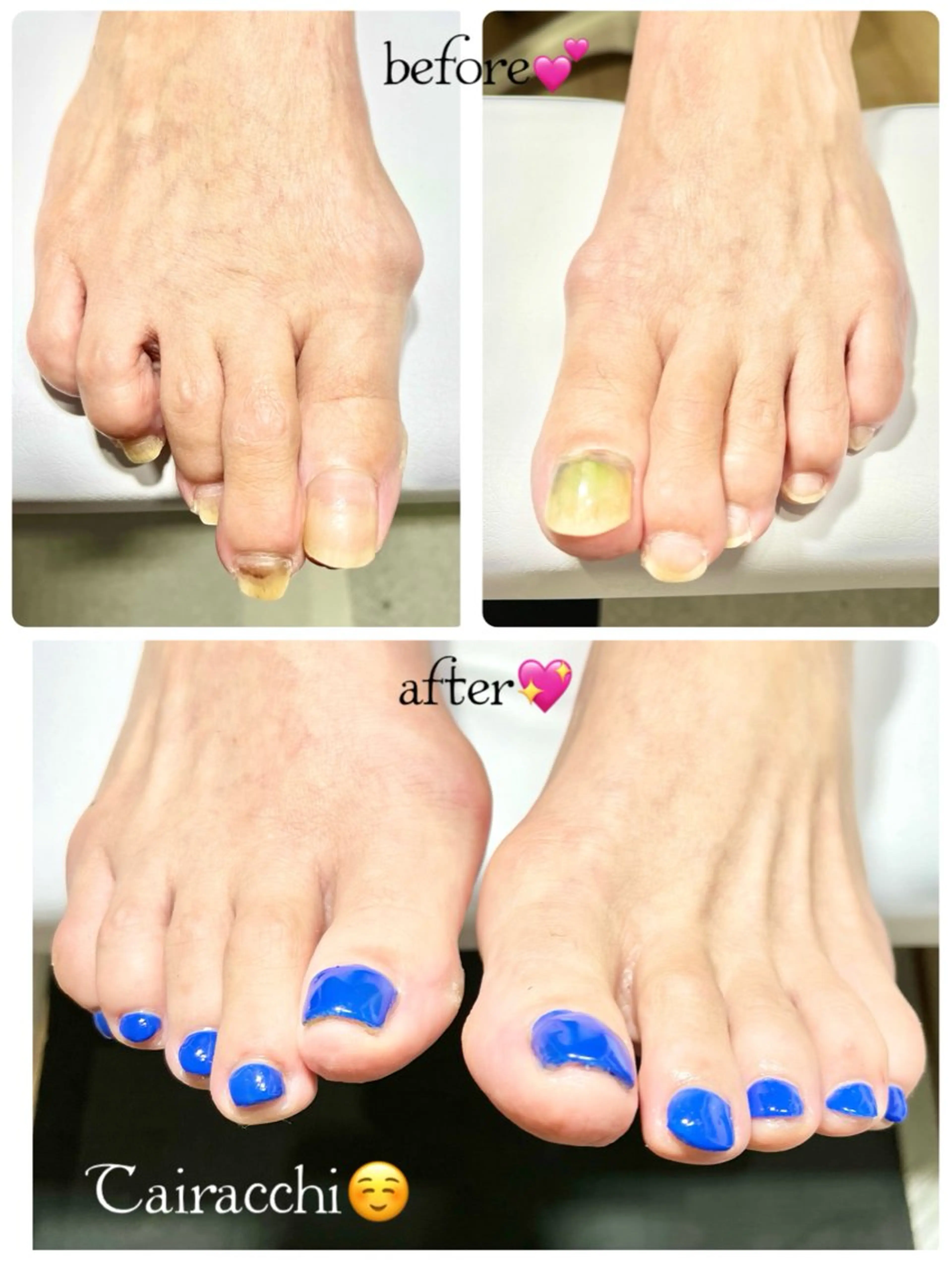 ネイル ブルー フットネイル ジェルネイル Tairacchi ﾀｲﾗｯﾁのネイルデザイン
