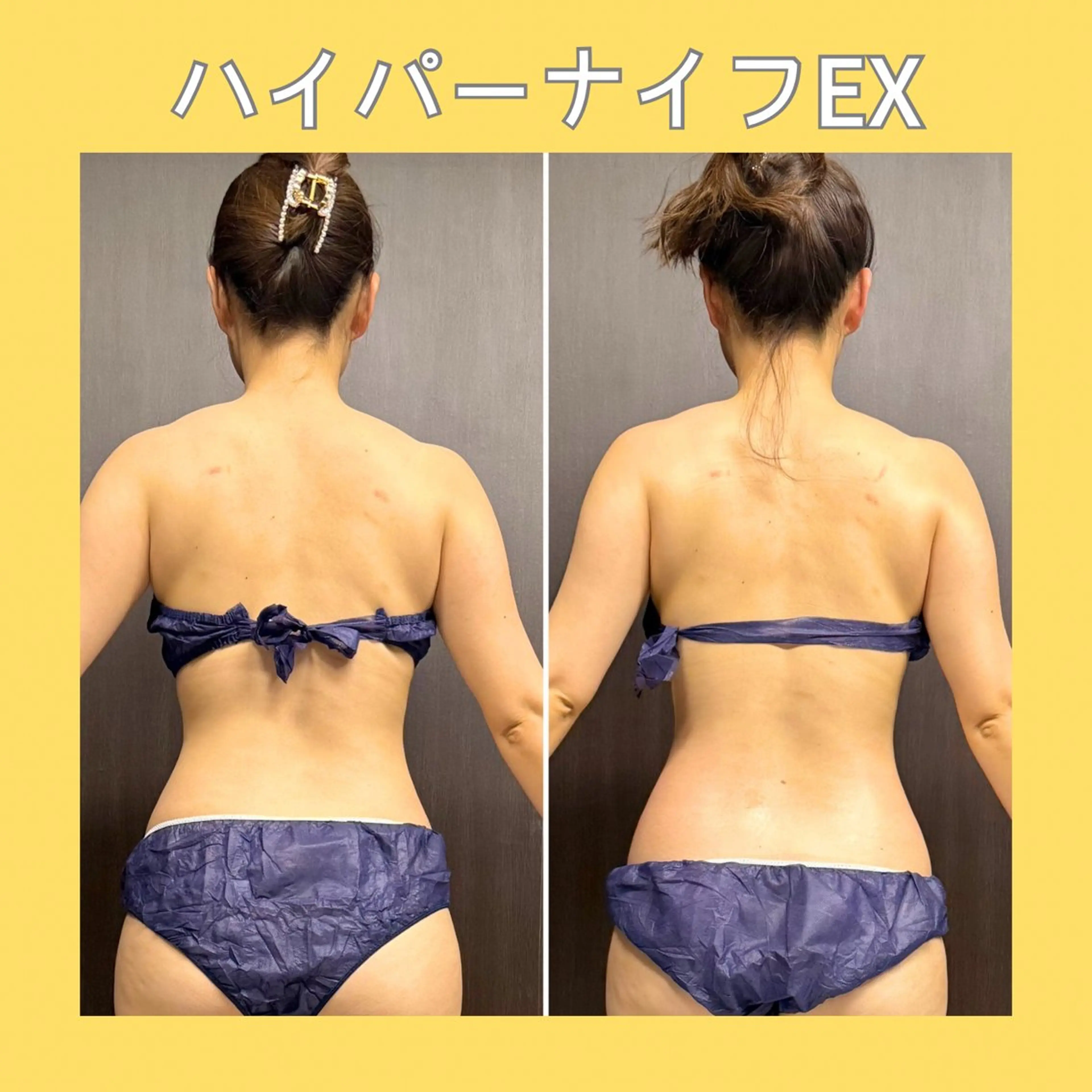 エステ 赤澤/本気痩せ・脱毛 ・ノーファンデ肌のその他イメージ